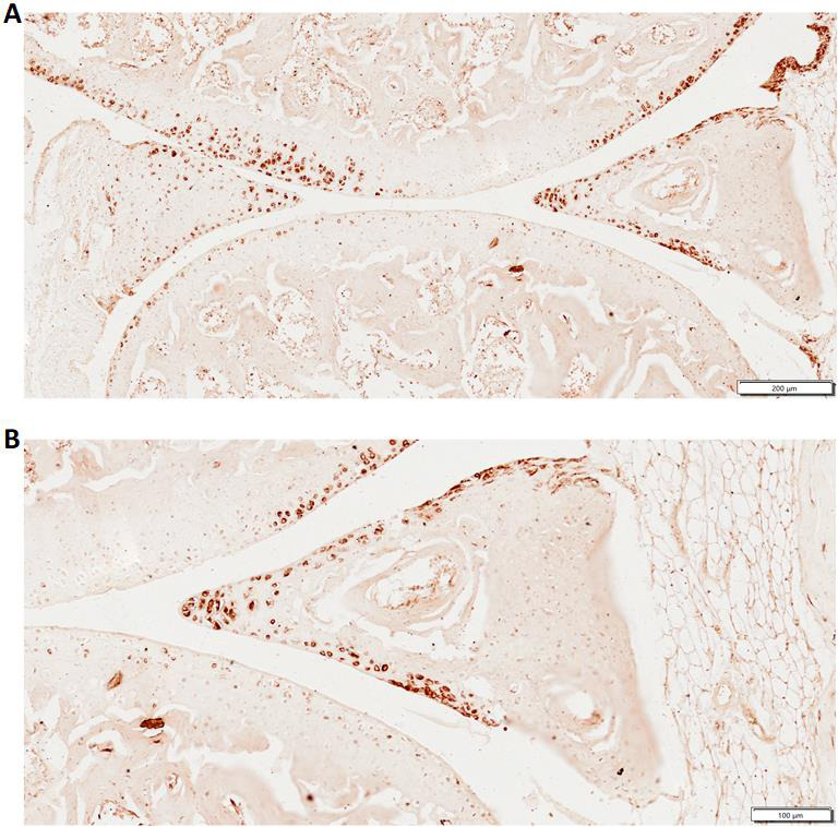 Fig. 2 
            Activin-like kinase 3 (ALK3) expression in a mouse knee joint. a) Whole joint. b) Meniscus. Three eight-week-old C57BL/6 J mice were provided by GemPharmatech (China). Immunohistochemistry staining on paraffin sections. Primary antibody ALK3, abcam, ab264043.
          