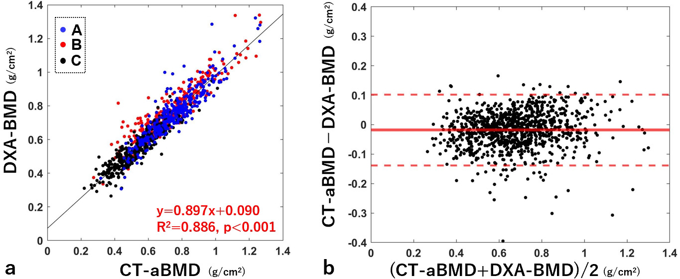 Fig. 2 
            a) Correlation plots between CT-aBMD and DXA-BMD and b) the corresponding Bland–Altman plot. For a), the blue, red, and black dots indicate cases from institutions A, B, and C, respectively. The black line indicates the regression line, and the red text indicates the regression equation, coefficient of determination, and p-value. The thick red line in b) indicates the mean value of the plots, and the thin red dotted lines indicate the 95% limits of agreement. aBMD, areal bone mineral density; DXA, dual-energy X-ray absorptiometry.
          