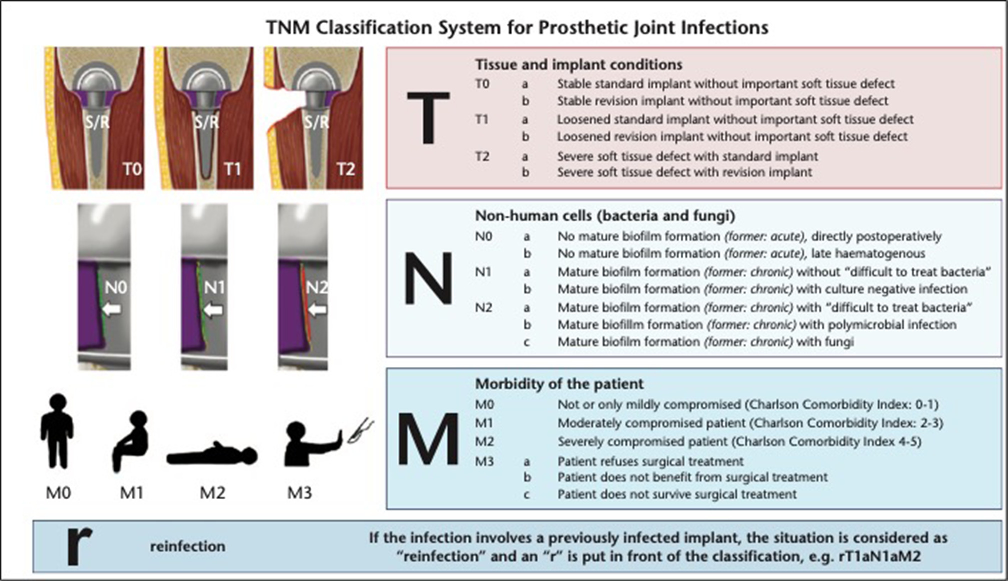 Fig. 1 
            The PJI-TNM classification system by Alt et al.15
          
