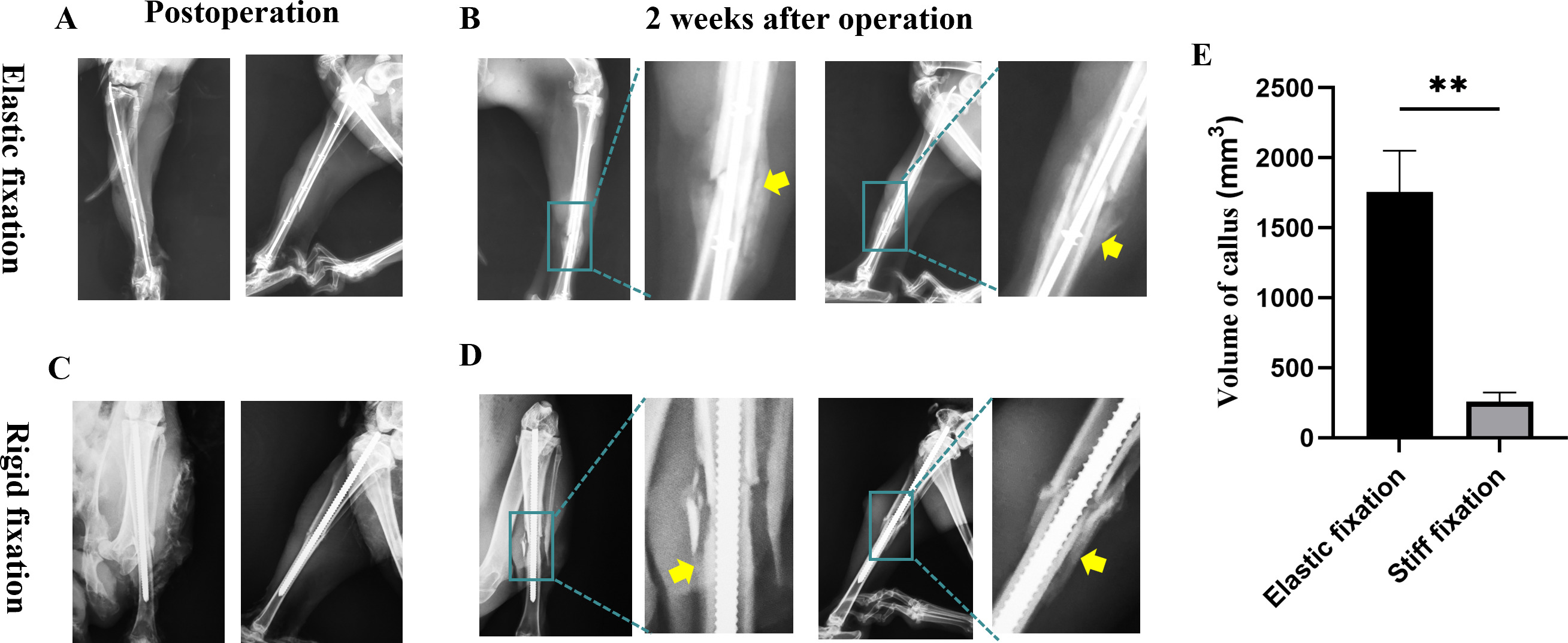 Fig. 4 
            Radiograph examination of different fixation methods for fractures. a) Closed reduction and elastic intramedullary fixation of tibial fractures. b) Radiograph examination after two weeks in the elastic fixation group. c) Closed reduction and stiff fixation of tibial fractures. d) Radiograph examination after two weeks in the stiff fixation group. e) Comparison of callus volume between two groups. **t-test, p＜0.01 versus stiff fixation group. Each experiment was independently repeated three times. The yellow arrow represents the new callus formation.
          