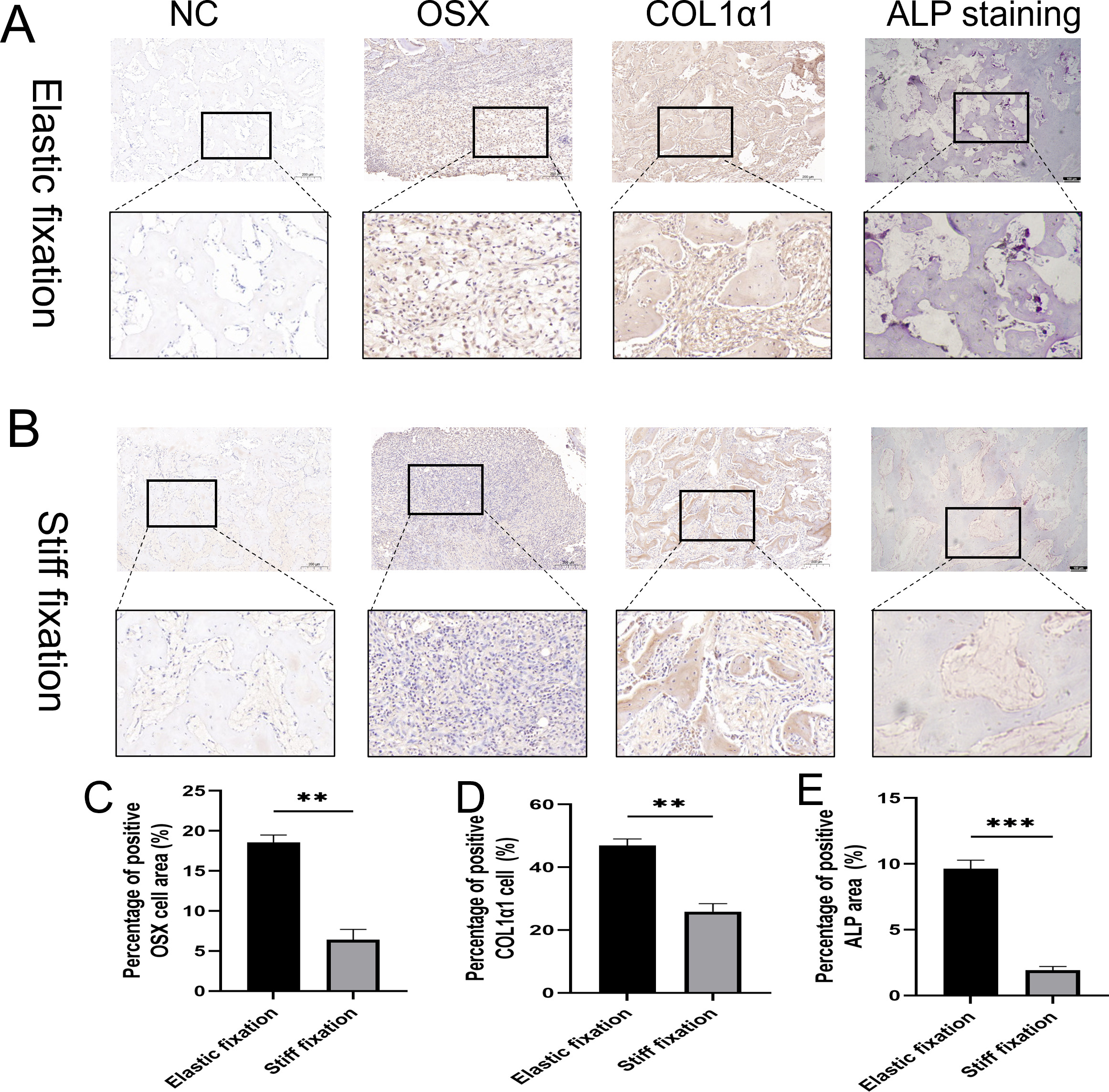 Fig. 5 
            Pathological examination of callus tissue. Osterix (OSX), collagen, type I, alpha 1 (COL1α1) immunohistochemistry staining (DAB staining, magnification factor 100×, scale bar = 200 µM), and alkaline phosphatase (ALP) staining (DAB staining, magnification factor 50×, scale bar = 100 µM) in a) the elastic fixation group and b) the stiff fixation group. c) to e) Quantitative analysis of OSX, COL1α1, and ALP. t-test, *p < 0.05, **p < 0.01, ***p < 0.001 versus the stiff fixation group, Each experiment was independently repeated three times.
          