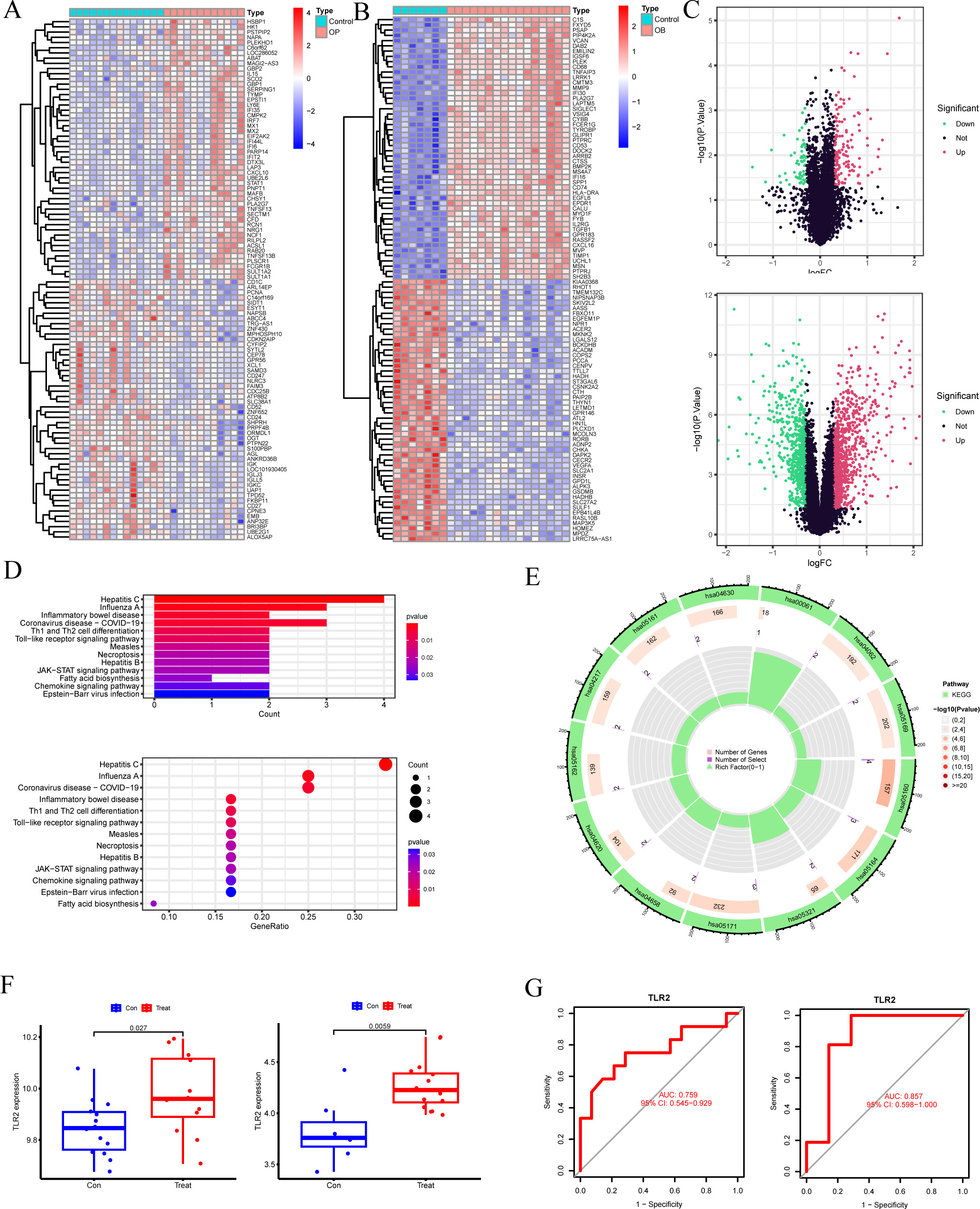 Fig. 4 
            Validation set: correlational analysis of differentially expressed genes (DEGs) associated with osteoporosis (OP) and obesity (OB). a) and b) Heatmap of DEGs, which visually displays the magnitude and clustering of gene expression levels. In the figure, a deeper colour denotes higher gene expression, while a lighter colour indicates lower expression. c) Volcano plot of DEGs combines statistical significance p-values with the fold change (logFC), facilitating a quick and intuitive identification of genes that are significantly altered and hold statistical relevance. d) and e) Bar graphs are commonly used to illustrate the enrichment level of each pathway, while bubble plots can showcase the enrichment levels alongside the number of genes. Within the bubble plot, the colour represents the p-value (or other metrics such as q-value), and the size signifies the number of genes, indicating the overlap between the submitted genes and those in a particular pathway/Gene Ontology (GO) term. Circle diagrams offer a more vivid depiction of the relationships between pathways. f) Box plot elucidates high expression levels of the Toll-like receptor 2 (TLR2) gene in both the OP and OB groups in the validation set, underscoring its statistical significance in gene expression. g) Receiver operating characteristic (ROC) curve of a single gene serves to assess the sensitivity and specificity of that gene as a biomarker for survival. The TLR2 gene demonstrates promising performance in the validation set, as portrayed by its ROC curve. All p-values were calculated with independent-samples t-test.
          