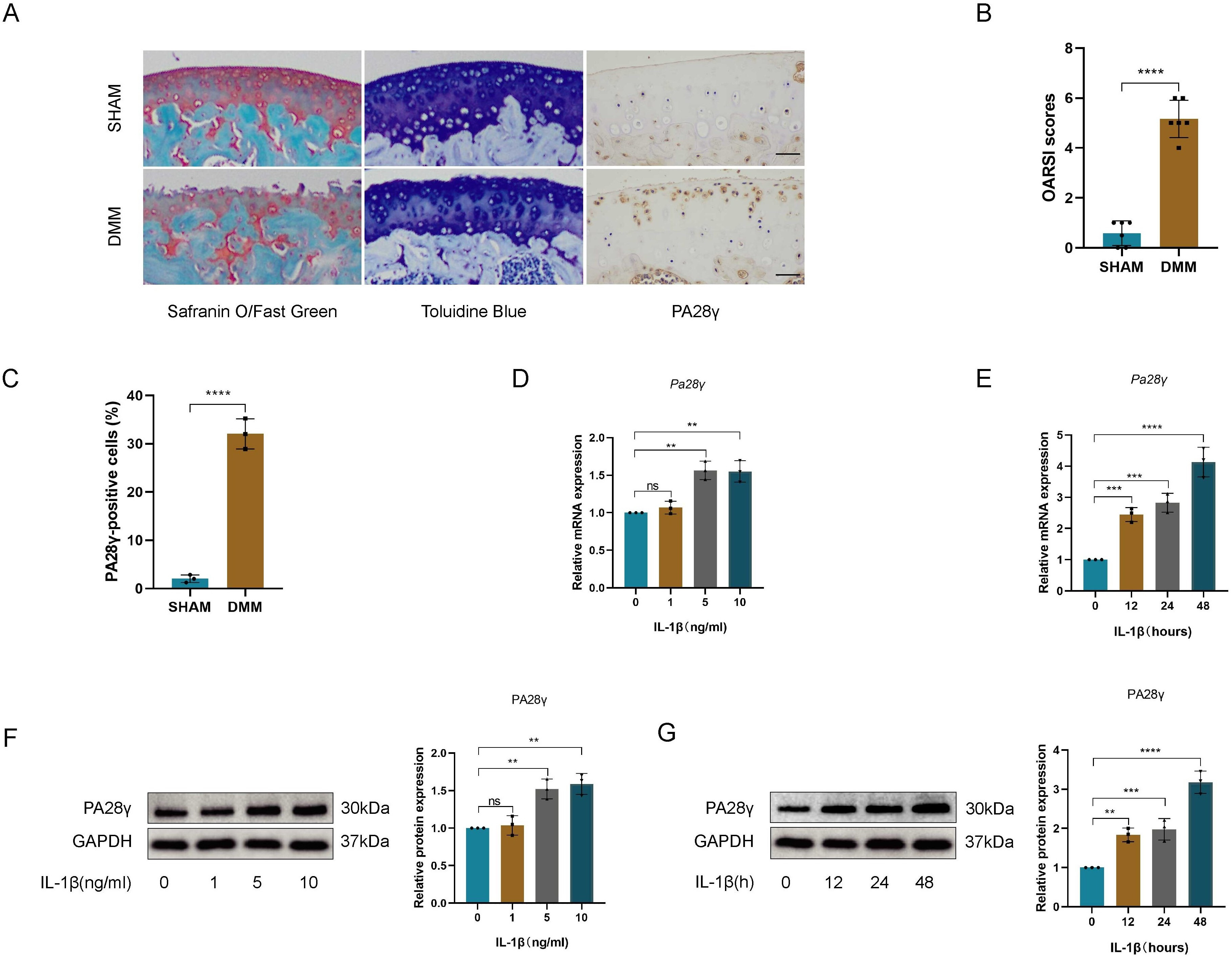 Fig. 2 
            PA28γ expression increased in both in vitro and in vivo models of osteoarthritis (OA). a) Representative safranin O/solid green staining images, toluidine blue staining images, and immunohistochemical images of PA28γ in articular cartilage of destabilized medial meniscus (DMM) and sham mice, measuring scale = 100 μm, magnification: ×200. b) Osteoarthritis Research Society International (OARSI) score of DMM and sham mice (n = 6, ****p < 0.0001). c) Quantitative analysis of PA28γ-positive chondrocyte in cartilage from DMM and sham mice (n = 3, ****p < 0.0001). d) PA28γ mRNA levels were measured by quantitative real-time polymerase chain reaction (qRT-PCR) after chondrocytes were stimulated with various concentrations of interleukin-1β (IL-1β) for 48 hours (**p < 0.01). e) PA28γ mRNA levels were measured by qRT-PCR after chondrocytes were stimulated with 5 ng/ml IL-1β for different durations (***p < 0.001, ****p < 0.0001). f) Western blotting and quantitative data of PA28γ expression 48 hours obtained after stimulating chondrocytes with various concentrations of IL-1β (**p < 0.01). g) PA28γ representative western blotting and quantitative data obtained after stimulating chondrocytes with 5 ng/ml IL-1β for different durations (**p < 0.01, ***p < 0.001, ****p < 0.0001).
          