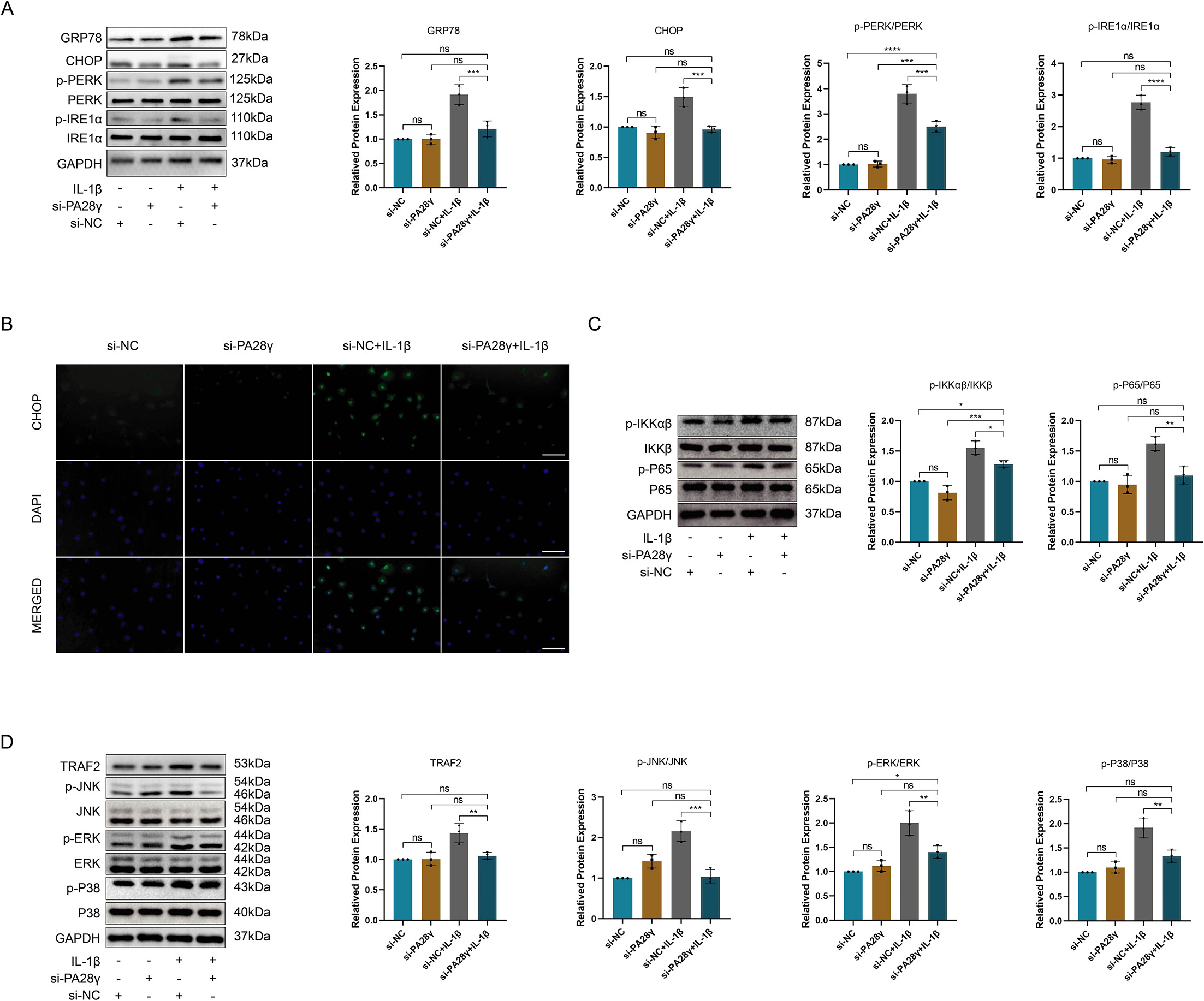 Fig. 5 
            Knockdown of PA28γ alleviates interleukin-1β (IL-1β)-induced endoplasmic reticulum (ER) stress in chondrocytes. a) Representative western blotting and quantitative data of GRP78, CHOP, PERK, p-PERK, IRE1α, and p-IRE1α after transfection of chondrocytes with si-NC or si-PA28γ and treatment with IL-1β (***p < 0.001, ****p < 0.0001). b) CHOP representative immunofluorescence images of chondrocytes transfected with si-NC or si-PA28γ and treated with IL-1β, measuring scale = 100 μm. c) Representative western blotting and quantitative data of IKKβ, p-IKKαβ, P65, and p-P65 after transfection of chondrocytes with si-NC or si-PA28γ and treatment with IL-1β (*p < 0.05, **p < 0.01, ***p < 0.001). d) Representative western blotting and quantitative data of tumour necrosis factor receptor-associated factor 2 (TRAF2), JNK, p-JNK, ERK, p-ERK, P38, and p-P38 after transfection of chondrocytes with si-NC or si-PA28γ and treatment with IL-1β (*p < 0.05, **p < 0.01, ***p < 0.001). DAPI, 4′,6-diamidino-2-phenylindole; GAPDH, glyceraldehyde-3-phosphate dehydrogenase; ns, not significant.
          