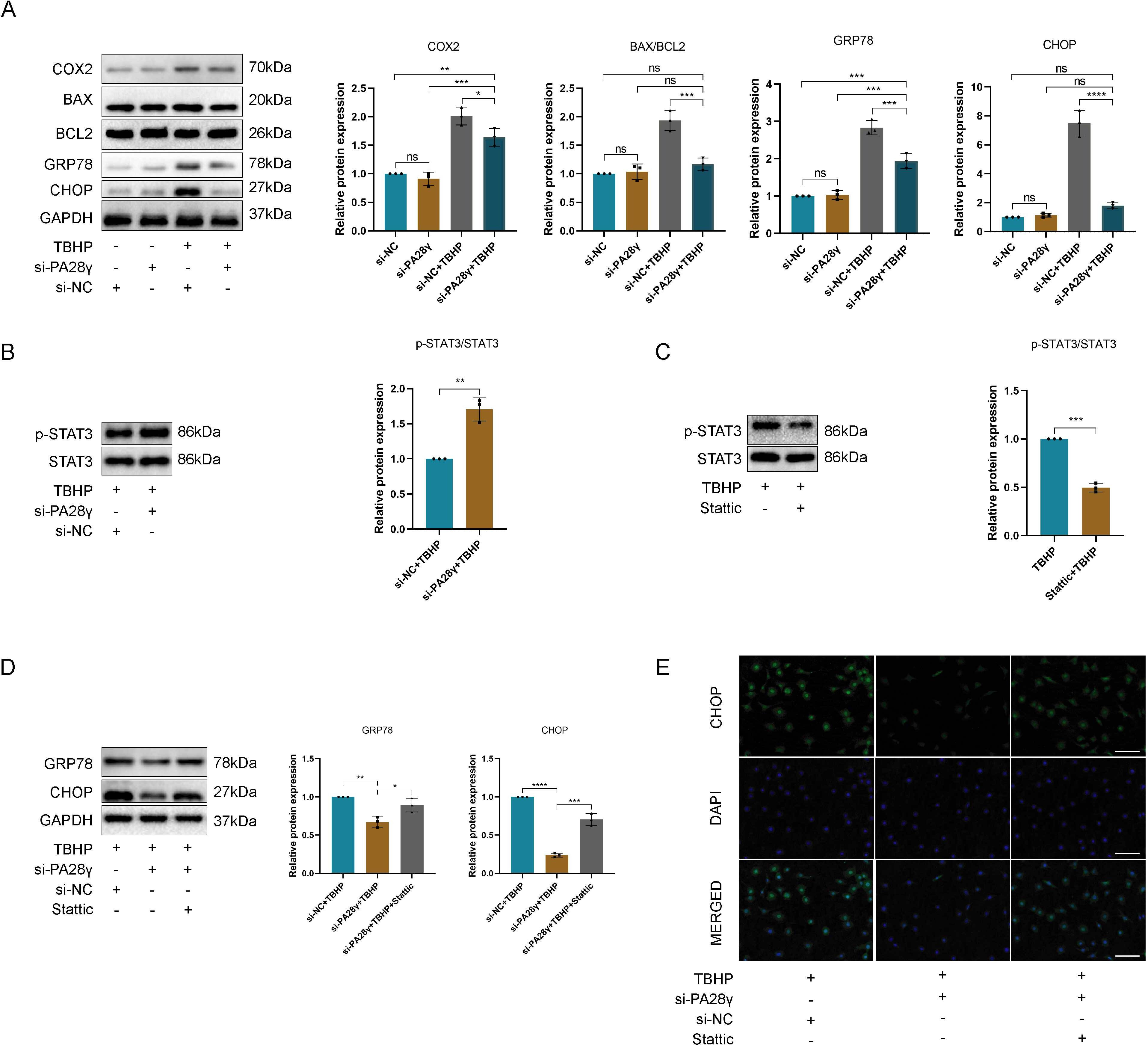 Fig. 6 
            PA28γ knockdown inhibits endoplasmic reticulum (ER) stress in chondrocytes by promoting signal transducer and activator of transcription 3 (STAT3) phosphorylation. a) Representative western blotting and quantitative data of COX2, BAX, BCL2, GRP78, and CHOP after transfection of chondrocytes with si-NC or si-PA28γ and treatment with tert-butylhydrogen peroxide (TBHP) (*p < 0.05, **p < 0.01, ***p < 0.001, ****p < 0.0001). b) Representative western blotting and quantitative data of STAT3 and p STAT3 after transfection of chondrocytes with si-NC or si-PA28γ and treatment with TBHP, **p < 0.01. c) Representative western blotting and quantitative data of STAT3 and p-STAT3 after treatment with TBHP and Stattic (***p < 0.001). d) Representative western blotting and quantitative data of GRP78 and CHOP after transfection of chondrocytes with si-NC or si-PA28γ and treatment with TBHP and Stattic (*p < 0.05, **p < 0.01, ***p < 0.001, ****p < 0.0001). e) CHOP representative immunofluorescence images of chondrocytes transfected with si-NC or si-PA28γ and treated with TBHP and Stattic, measuring scale = 100 μm, magnification: ×200. DAPI, 4′,6-diamidino-2-phenylindole; GAPDH, glyceraldehyde-3-phosphate dehydrogenase; ns, not significant.
          