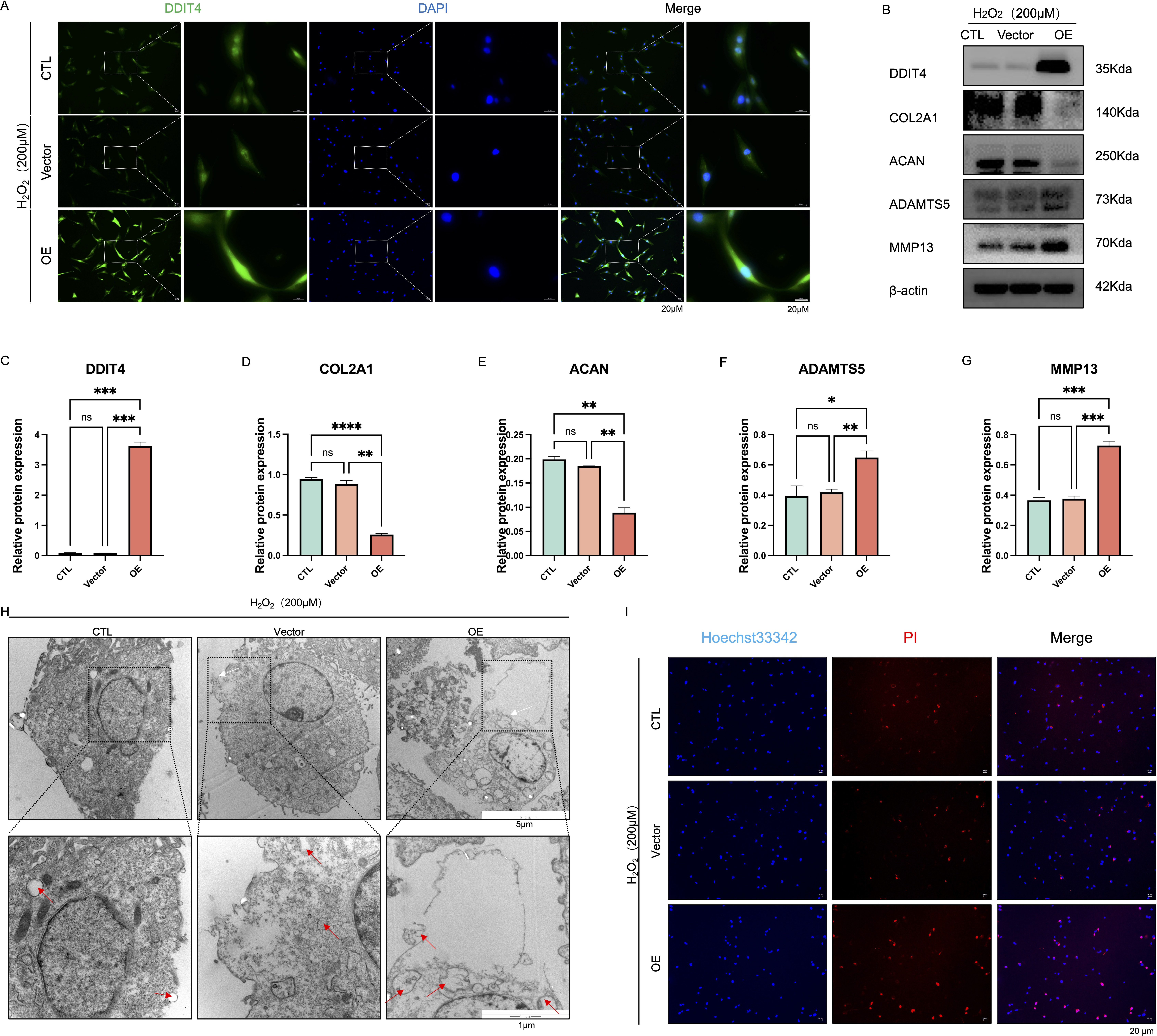 Fig. 3 
            Upregulation of DDIT4 aggravates pyroptosis of nucleus pulposus cells (NPCs) under oxidative stress. DDIT4 was overexpressed in NPCs, and NPCs were treated with 200 μM hydrogen peroxide for 24 hours. a) Immunofluorescence analysis of DDIT4 after hydrogen peroxide treatment in the control, vector, and overexpression groups; scale bars, 20 μm. b) to g) Representative images of western blotting and quantitative analysis of DDIT4, COL2A1, ACAN, ADAMTS5, and matrix metalloproteinase 13 (MMP13) in the control, vector, and overexpression groups after hydrogen peroxide treatment. h) Transmission electron microscope images of NPCs treated with hydrogen peroxide in the control, vector, and overexpression groups, such as cytoplasmic oedema, swelling of cell membrane, karyopyknosis, and organelle cavitation; white arrows show swelling of cell membran, while red arrows show organelle cavitation. Scale bars in overall view: 5 μm; scale bars in local view: 1 μm. i) Representative fluorescence images of Hoechst 33342/PI staining of NPCs treated with hydrogen peroxide in the control, vector, and overexpression groups. Scale bars, 20 μm. Data are expressed as the mean and standard deviation of at least three independent experiments. Two-way analysis of variance was used for statistical analysis (ns, no statistical significance; *p < 0.05; **p < 0.01; ***p < 0.001; ****p < 0.0001).
          