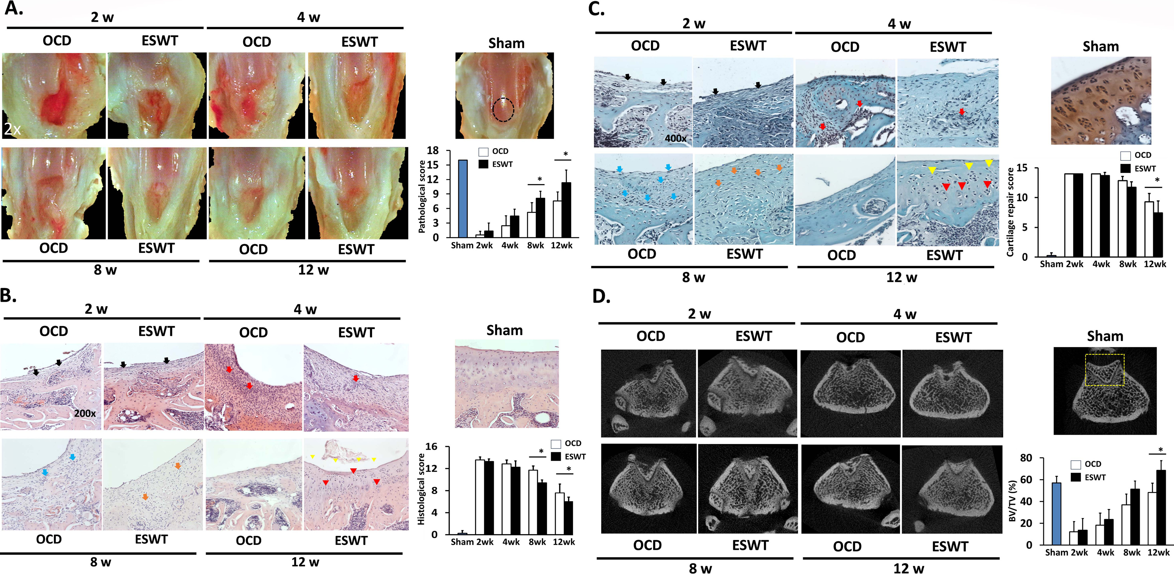 Fig. 1 
            The evaluated tissue profiles from the Sham, osteochondral defect (OCD), and extracorporeal shockwave therapy (ESWT) groups at two, four, eight, and 12 weeks. a) Macroscopic changes in each group are observed and quantified using International Cartilage Repair Society pathological scores (magnification: ×2). b) Histological changes are examined through haematoxylin and eosin staining in each group, with scores calculated using Pineda’s histological scoring system (magnification: ×200).23 c) Cartilage regeneration is assessed using Safranin-O staining in each group, and scores are determined using Wakitani’s cartilage repair scoring system (magnification: ×400).24 d) Micro-CT images and analysis are conducted to evaluate new bone formation, quantified by percentage of bone volume fraction (BV/TV%). *p < 0.05 (Mann-Whitney U test), comparing between OCD and ESWT groups.
          