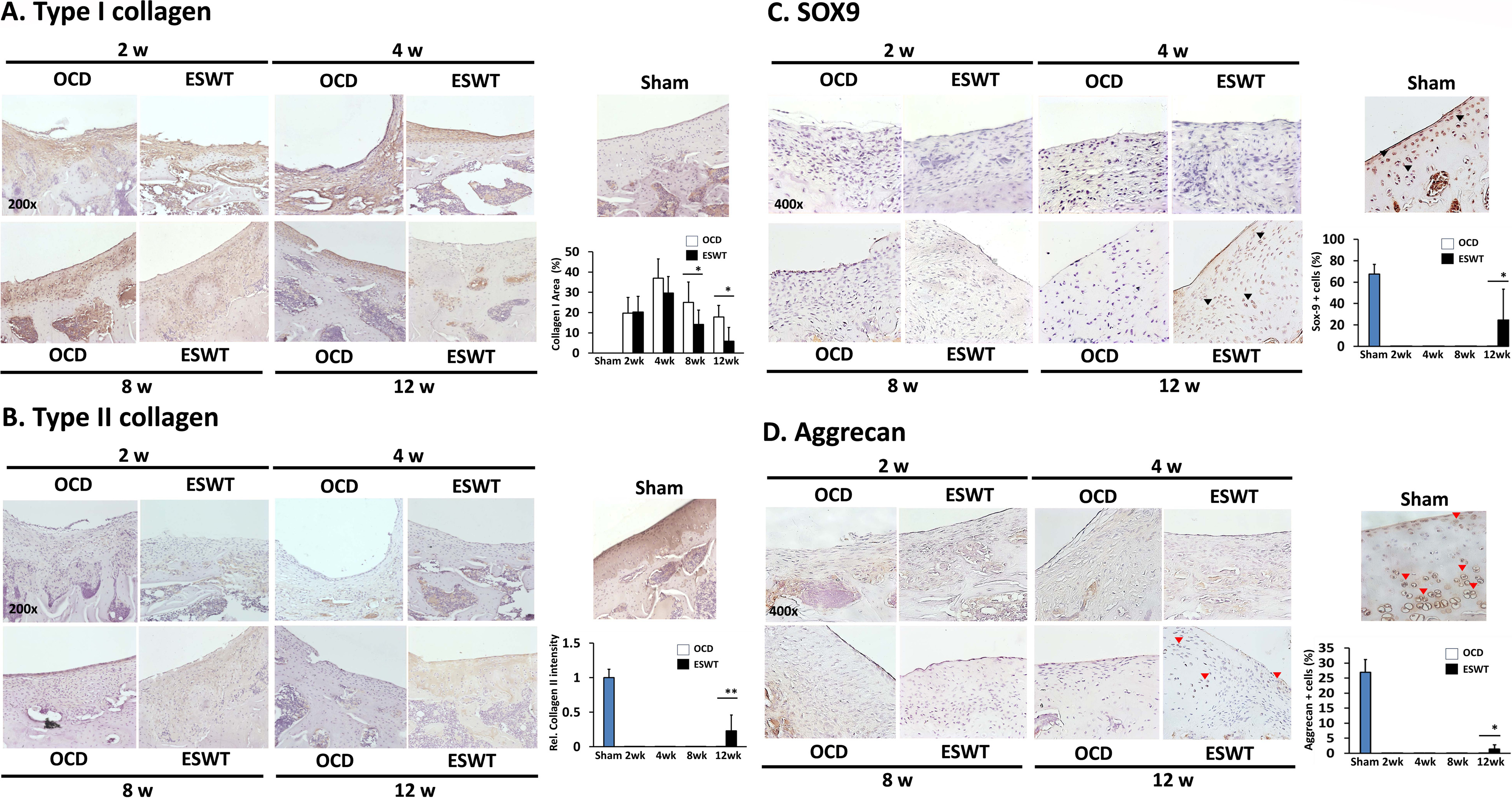 Fig. 2 
            The immunohistochemical (IHC) images and expression levels of type I collagen, type II collagen, SRY-box transcription factor 9 (SOX9), and aggrecan. a) type I collagen (×200 magnification), b) type II collagen (×200 magnification), c) SOX9 (×400 magnification), and d) aggrecan (×400 magnification) as well as the expression levels at two, four, eight, and 12 weeks. *p < 0.05 and **p < 0.01, comparing osteochondral defect (OCD) and extracorporeal shockwave therapy (ESWT) groups.
          