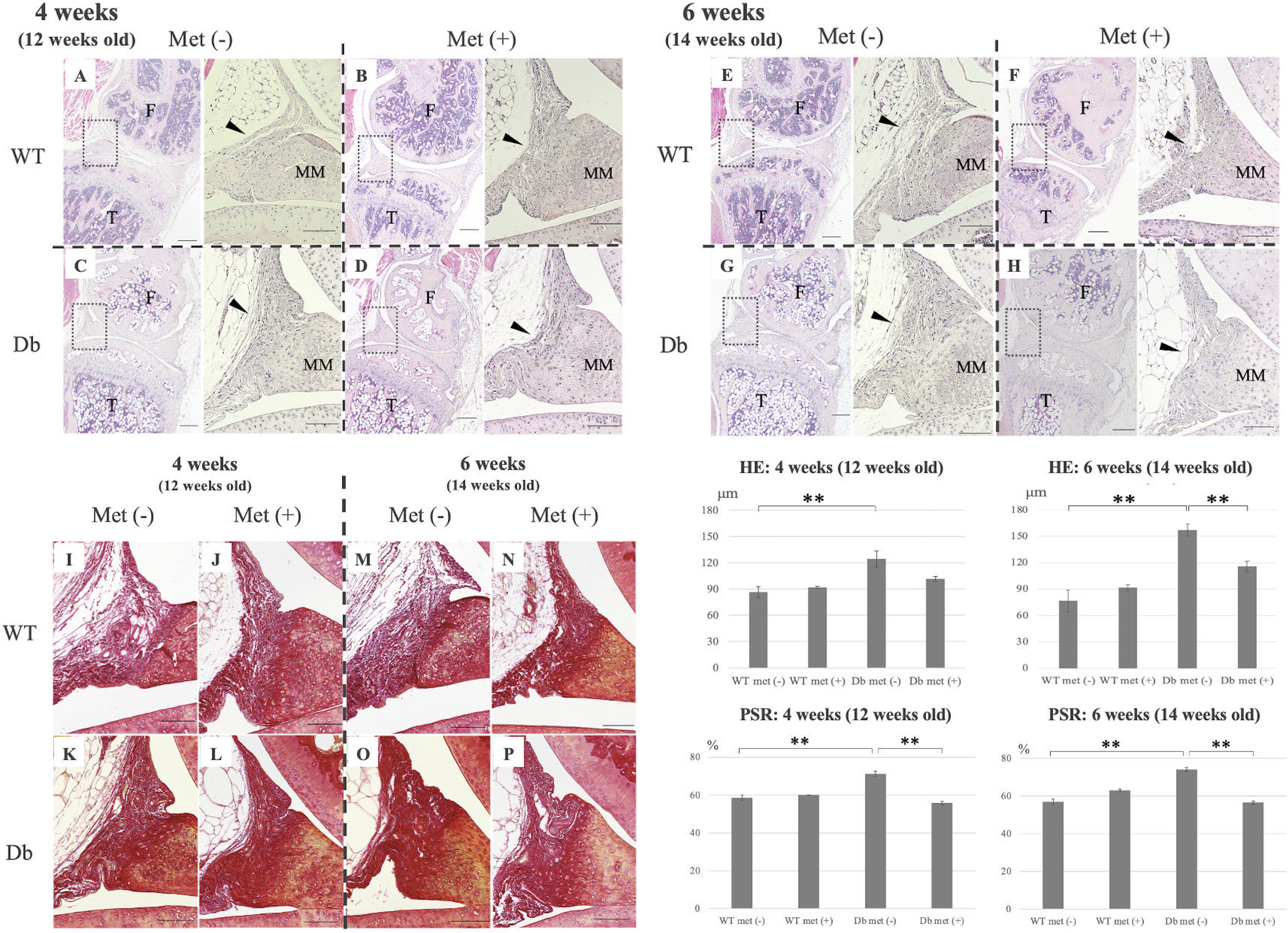 Fig. 3 
            Histological analysis of the effect of metformin on the knee joint capsule. Haematoxylin and eosin stained sections of knee joint capsule from each group after four and six weeks (low magnification, 20x). Arrows indicate posterior knee joint capsule. Each right-side image shows a higher magnification image (400x) of the dotted box of the corresponding left-side image (scale bar: 300 μm (right), 100 μm (left)). **p < 0.01; n = 6. At four weeks (12-weeks-old) A: WT met(-), B: WT met(+), C: Db met(-), D: Db met(+); at six weeks (14-weeks-old) E: WT met(-), F: WT met(+), G: Db met(-), H: Db met(+). Picrosirius Red-stained (PRS) sections (scale bar: 100 μm, magnification 400x) of posterior knee joint capsule for each group at four and six weeks of metformin treatment. The percentage of collagen fibres in the posterior capsule at four and six weeks was measured as the ratio of the total area stained red by PRS to the area of the posterior capsule. Data are expressed as mean and standard error. **p < 0.01; n = 6. At four weeks (12-weeks-old) I: WT met(-), J: WT met(+), K: Db met(-), L: Db met(+); at six weeks (14-weeks-old) M: WT met(-), N: WT met(+), O: Db met(-), P: Db met(+).
          