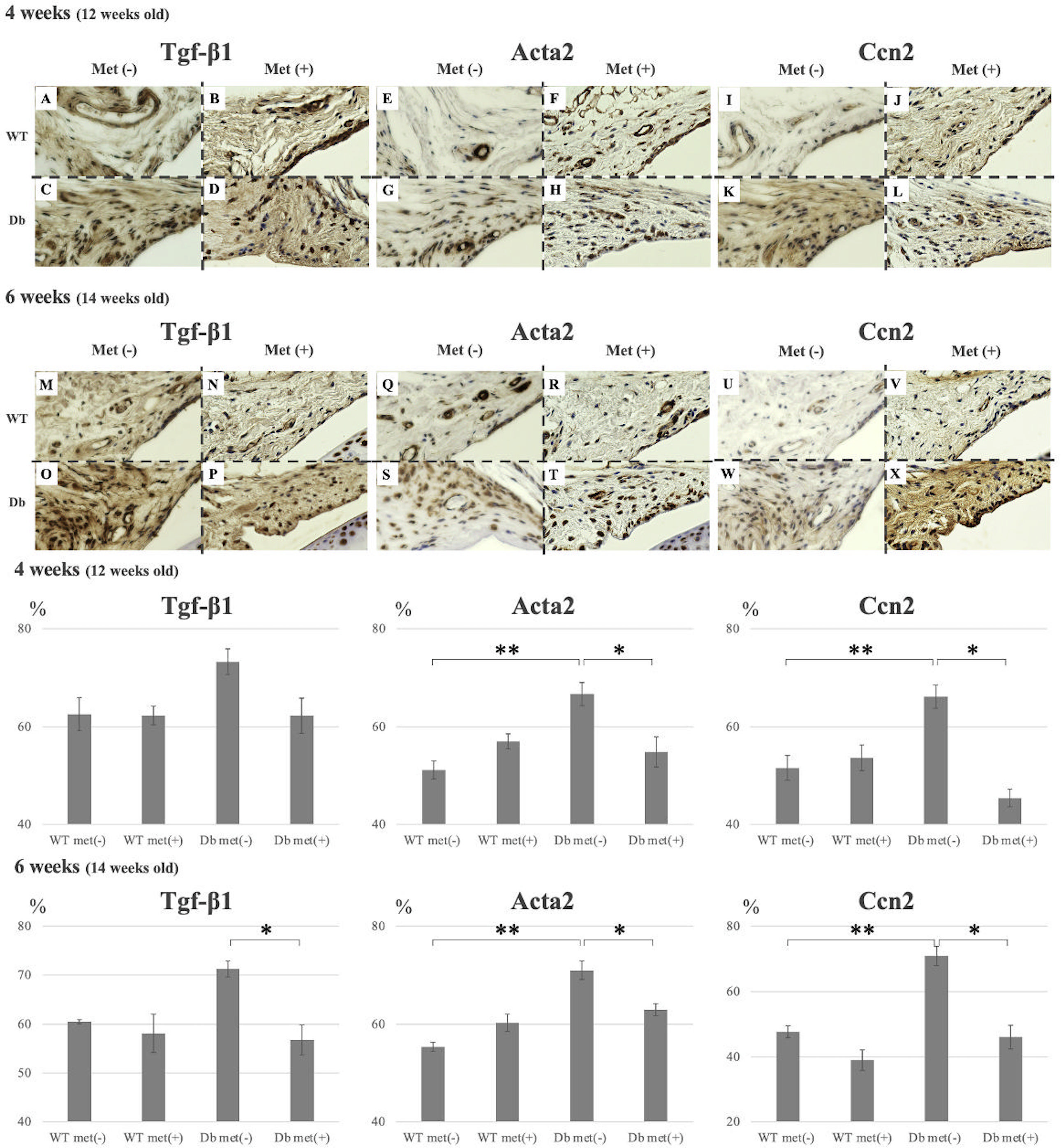 Fig. 4 
            Immunohistochemical analysis of the effect of metformin on the posterior knee joint capsule. The proportion of transforming growth factor β1 (TGFβ1)-positive-, actin α2 (Acta2)-positive-, and cellular communication network factor 2 (Ccn2)-positive cells relative to the total number of cells in the posterior capsule of each group are presented at four and six weeks of metformin treatment. The threshold of the total number of cells was set to 80 ± 10 pixels (px) for each image, and that of each type of positive cell was set to 25 ± 5 px. Data are expressed as mean and standard error of the mean (SEM). *p < 0.05, **p < 0.01; n = 6. At four weeks (12 weeks old), TGF-β1 A: wild-type (WT) met(-), B: WT met(+), C: diabetes mellitus (Db) met(-), D: Db met(+); Acta2 E: WT met(-), F: WT met(+), G: Db met(-), H: Db met(+); Ccn2 I: WT met(-), J: WT met(+), K: Db met(-), L: Db met(+); at six weeks (14 weeks old), TGF-β1 M: WT met(-), N: WT met(+), O: Db met(-), P: Db met(+); Acta2 Q: WT met(-), R: WT met(+), S: Db met(-), T: Db met(+); Ccn2 U: WT met(-), V: WT met(+), W: Db met(-), X: Db met(+).
          