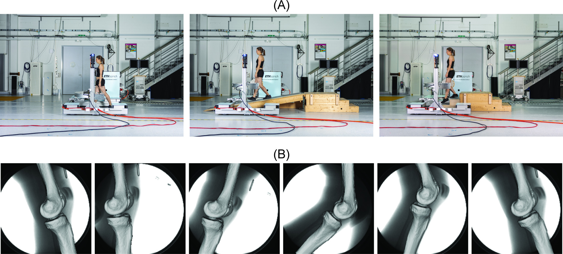 Fig. 2 
            a) Subject tracked by the moving fluoroscope during level walking (left), downhill walking (middle), and stair descent (right). b) Series of fluoroscopic images with registered femur and tibia bone models during level walking.
          