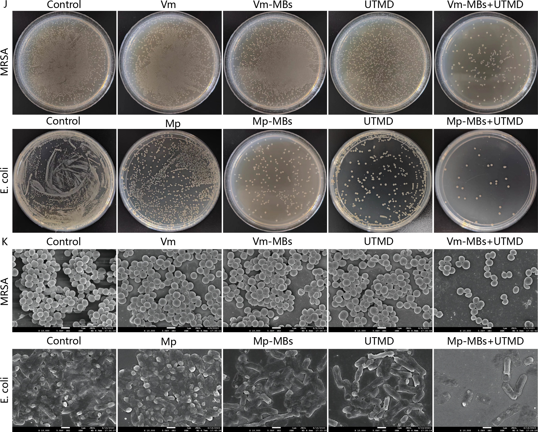 Fig. 5 
            Treatment of methicillin-resistant Staphylococcus aureus (MRSA) and Escherichia coli biofilms with vancomycin-microbubbles (Vm-MBs) or meropenem (Mp)-MBs + ultrasound-targeted microbubble destruction (UTMD) in vitro. a) Relative standard plate-counting method of MRSA and E. coli biofilms after various treatments. b) Scanning electron microscopy (SEM) images of MRSA and E. coli biofilms after various treatments (10,000×). The results are presented as mean and SD (n = 3).
          