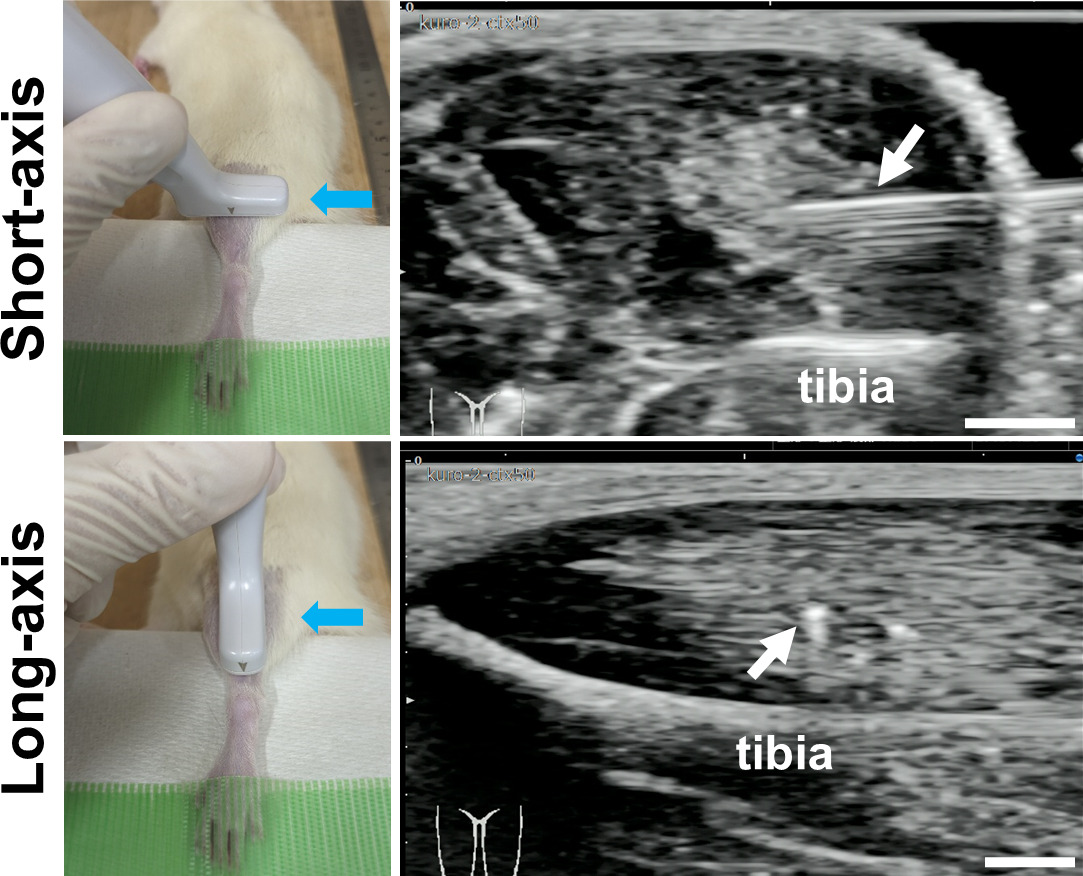 Fig. 1 
            Ultrasound-guided cardiotoxin injection into rat tibialis anterior muscle. In the macroscopic photographs, probe positions during long-axis/short-axis imaging are shown. Blue arrows indicate the direction of needle puncture. In the ultrasound images, positions of the needle in the muscle tissue are indicated with white arrows. Scale bars = 2 mm.
          