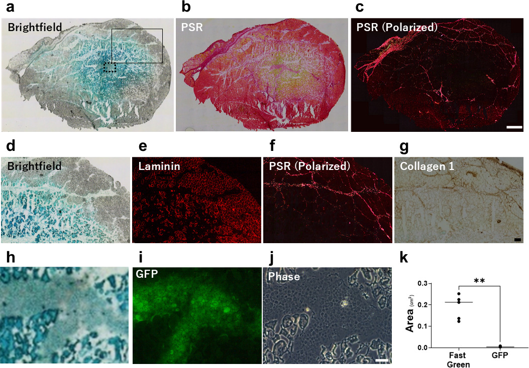 Fig. 4 
            The distribution of the injected solution and cells. a) to j) Images of cryosections immediately created after injection. a) Brightfield image. b) and c) Images of staining with Picrosirius red (PSR). d) to g) Images of area indicated by solid line in panel a). d) Brightfield image. e) Image of staining with anti-laminin antibody. f) Image of staining with PSR. g) Image of staining with anti-collagen 1 antibody. h) to j) Images of area indicated by dotted line in panel a). h) Brightfield image. i) GFP-positive cells. j) Image of phase contrast. k) Graph showing a comparison between Fast Green-stained and GFP-positive areas. Scale bars = 1 mm for upper panels, 200 μm for middle panels, and 100 μm for lower panels.
          