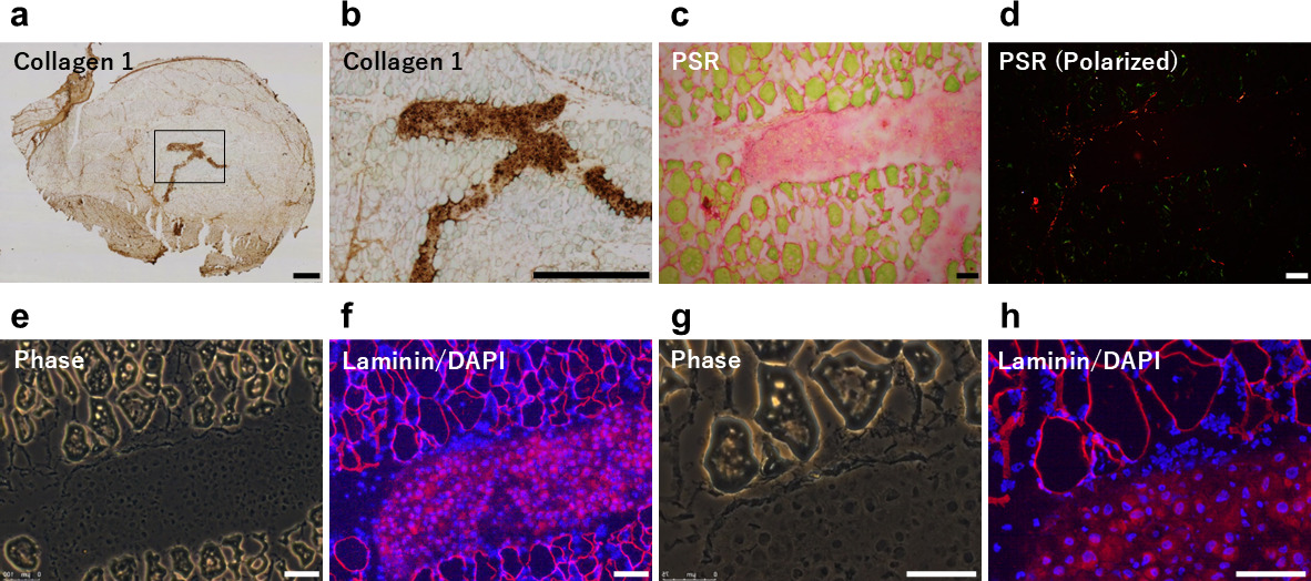 Fig. 5 
            The relationship between muscle membranes and distribution of injected cells. a) and b) Images of staining with anti-collagen 1 antibody. Solid line in panel a) indicates area shown in panel b). The cells were distributed in a pattern along the perimysium. c) to h) Images of injected cells in injured muscle tissue. c) and d) Images of staining with Picrosirius red. Fragmented red signals were observed at the margins of the cell aggregates. e) to h) The merged images labelled with laminin (red) and nuclei with 4′,6-diamidino-2-phenylindole (DAPI) (blue). No clear contact between the laminin staining and cell aggregates was observed. Scale bars = 100 μm.
          