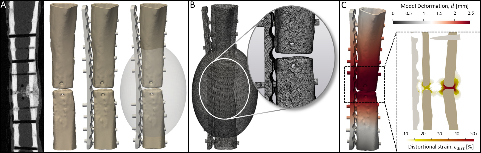 Fig. 1 
            a) Operated tibia models were created from the microCT scans at nine weeks, and the implants were implanted virtually. b) Bone and implant models were meshed with a negligible-stiffness sub-model around the fracture gap zone to visualize strain in this region. c) Calculated deformations from the bone and implant models were used as displacement boundary conditions in the strain visualization sub-models, producing calculated strain values for the entire perifragmentary region (inset).
          