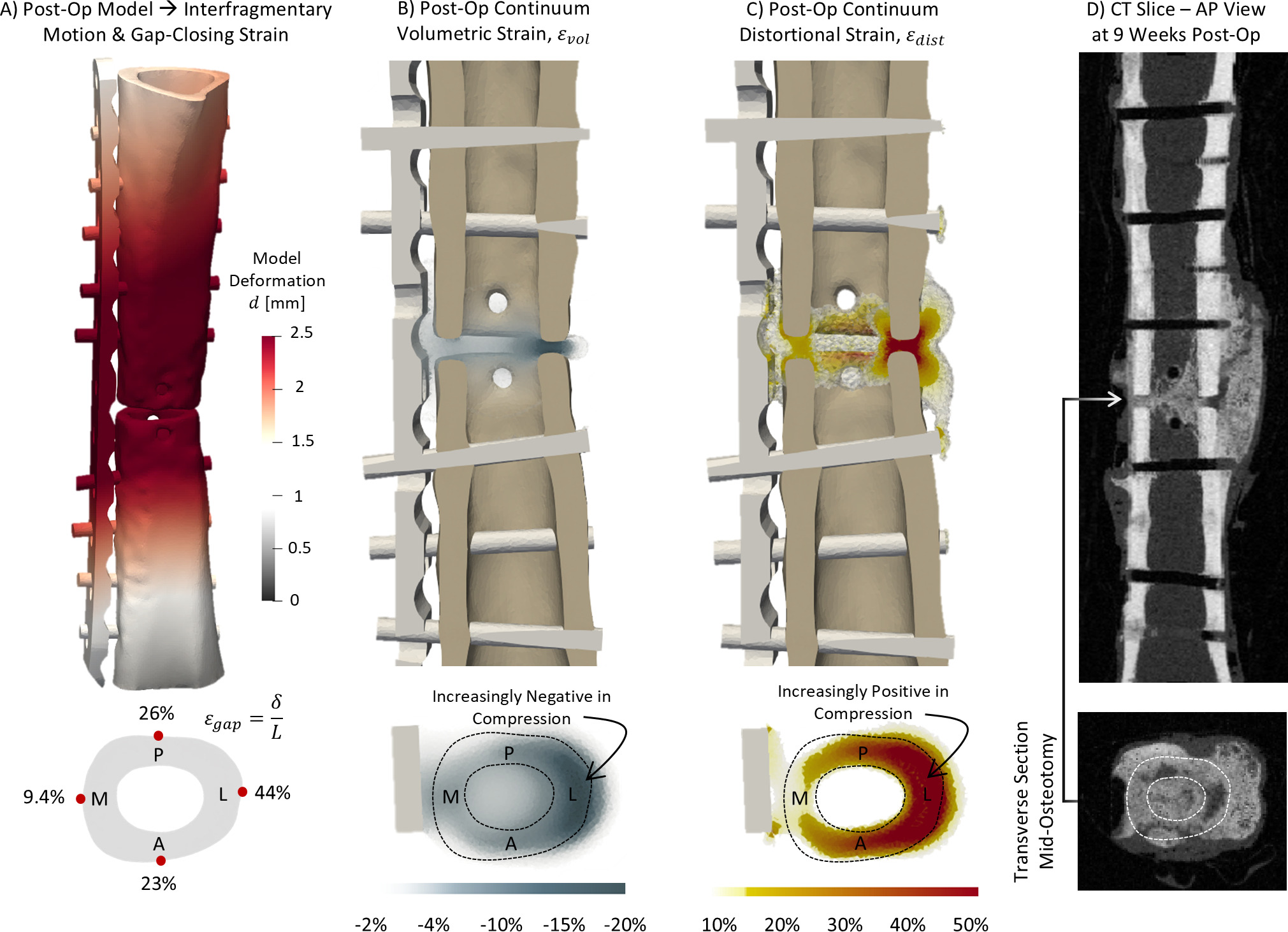 Fig. 4 
            a) Representative postoperative (unhealed) model showing highest gap-closing strains at the far cortex due to plate bending. Continuum strains calculated in the perifragmentary zone show concentrations of compressive b) volumetric strain and c) distortional strain immediately within and around the fracture gap. d) Post-mortem microCT at nine weeks shows a successfully bridged callus with pockets of delayed mineralization at the fracture line.
          