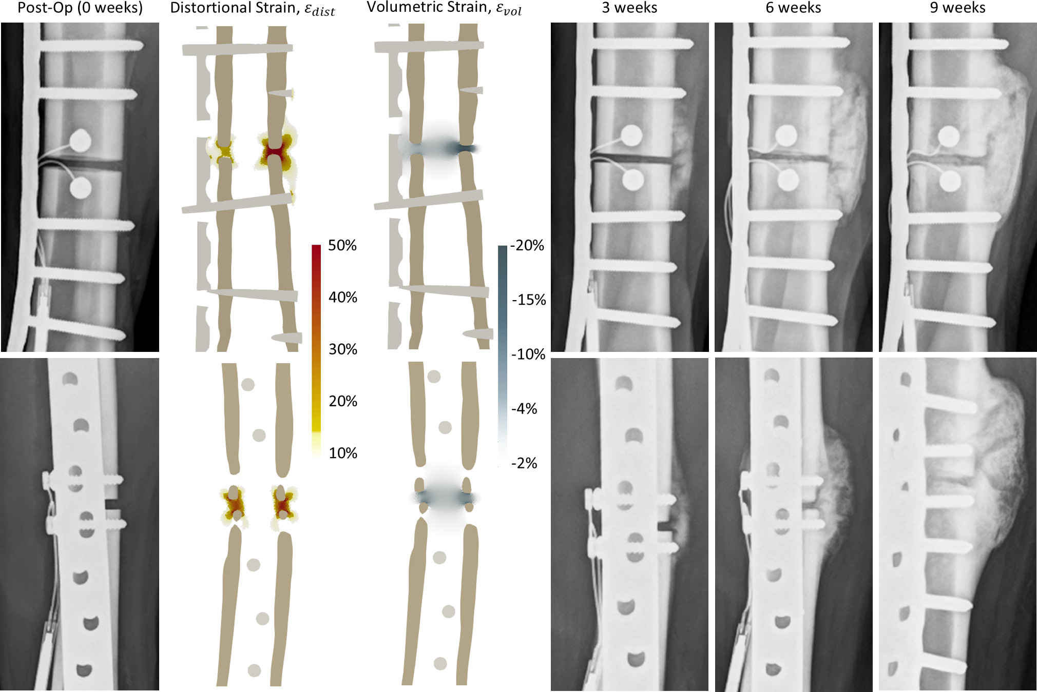 Fig. 7 
          Side-by-side view of distortional and volumetric strain contours with anteroposterior (top row) and mediolateral (bottom row) radiographs, which show that callus mineralization initiates outside the high-strain perifragmentary zone.
        