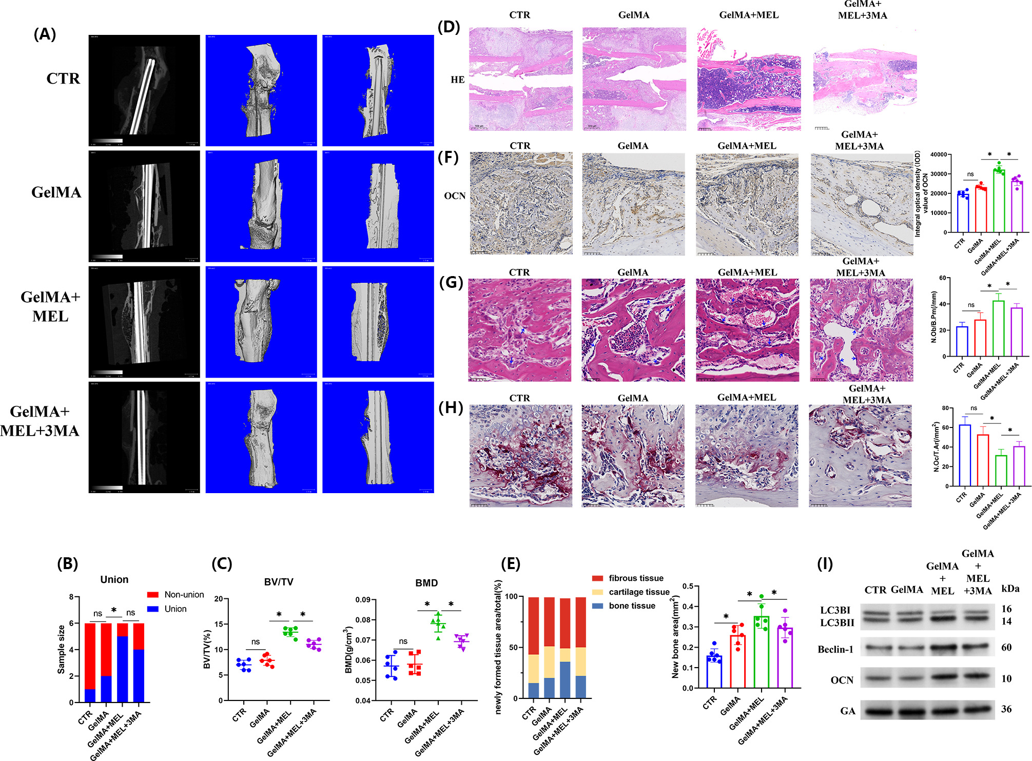 Fig. 5 
            Administration of melatonin (MEL) has therapeutic effects on bone fracture healing in aged mice. a) Representative radiograph and micro-CT (μCT) of femora in aged mice (n = 6 per group) four weeks after open femoral mid-shaft fracture. b) Nonunion frequency and c) μCT measurement of bone volume per total volume (BV/TV) and bone mineral density (BMD) in callus area of the fractured femora four weeks after open femoral mid-shaft fracture. d) Haematoxylin and eosin (H&E) staining (50×) of fractured femur. e) Ratio of newly formed bone, cartilage, and fibrous tissue area and quantification of the area of new bone formation. f) Immunohistopathology (200×) of fractured femur, showing the osteogenic-related protein matricellular protein osteocalcin (OCN) in the fracture callus. The integral optical density (IOD) of OCN was calculated. g) Osteoblast counts in the fracture callus were assessed by counting the number of osteoblasts on each H&E-stained section, with osteoblast number/bone perimeter (N.Ob/B.Pm) (/mm) determined using Image-Pro Plus software (Media Cybernetics, USA). Blue arrows indicate typical osteoblasts in the sections, highlighting their distribution in the fracture callus. h) Evaluation of osteoclasts in fracture callus. The numbers of osteoclasts were counted based on tartrate-resistant acid phosphatase (TRAP)-stained sections, and osteoblast number/total area (N.OC/T.Ar) (/mm2) was determined by Image-Pro Plus software. i) Protein presentations from bone marrow-derived mesenchymal stem cells (BMMSCs) extracted from tibiae after fracture healing of autophagy markers LC3BII, Beclin, and the osteogenesis marker OCN. *p < 0.05, significant differences between each indicated group analyzed using Fisher's exact test, one-way analysis of variance (ANOVA), or Tukey’s post-hoc test. CTR, control group; GelMA, methacrylated gelatin; ns, not significant.
          