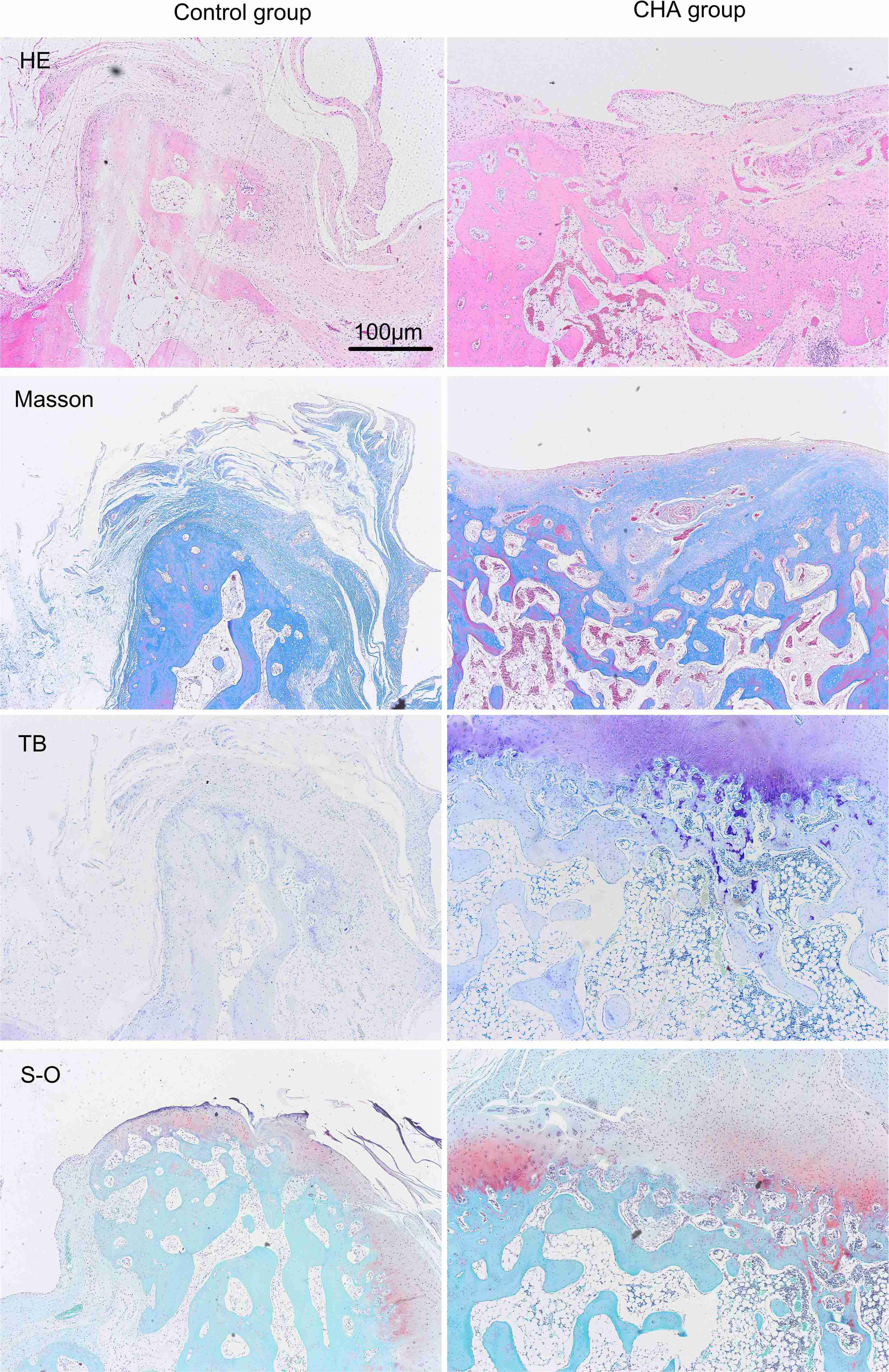 Fig. 5 
            Histological staining of bone tissues. CHA, collagen-nanohydroxyapatite scaffold; HE, haemotoxylin and eosin; Masson, Masson’s trichrome staining; S-O, safranin O; TB, Toluidine blue.
          