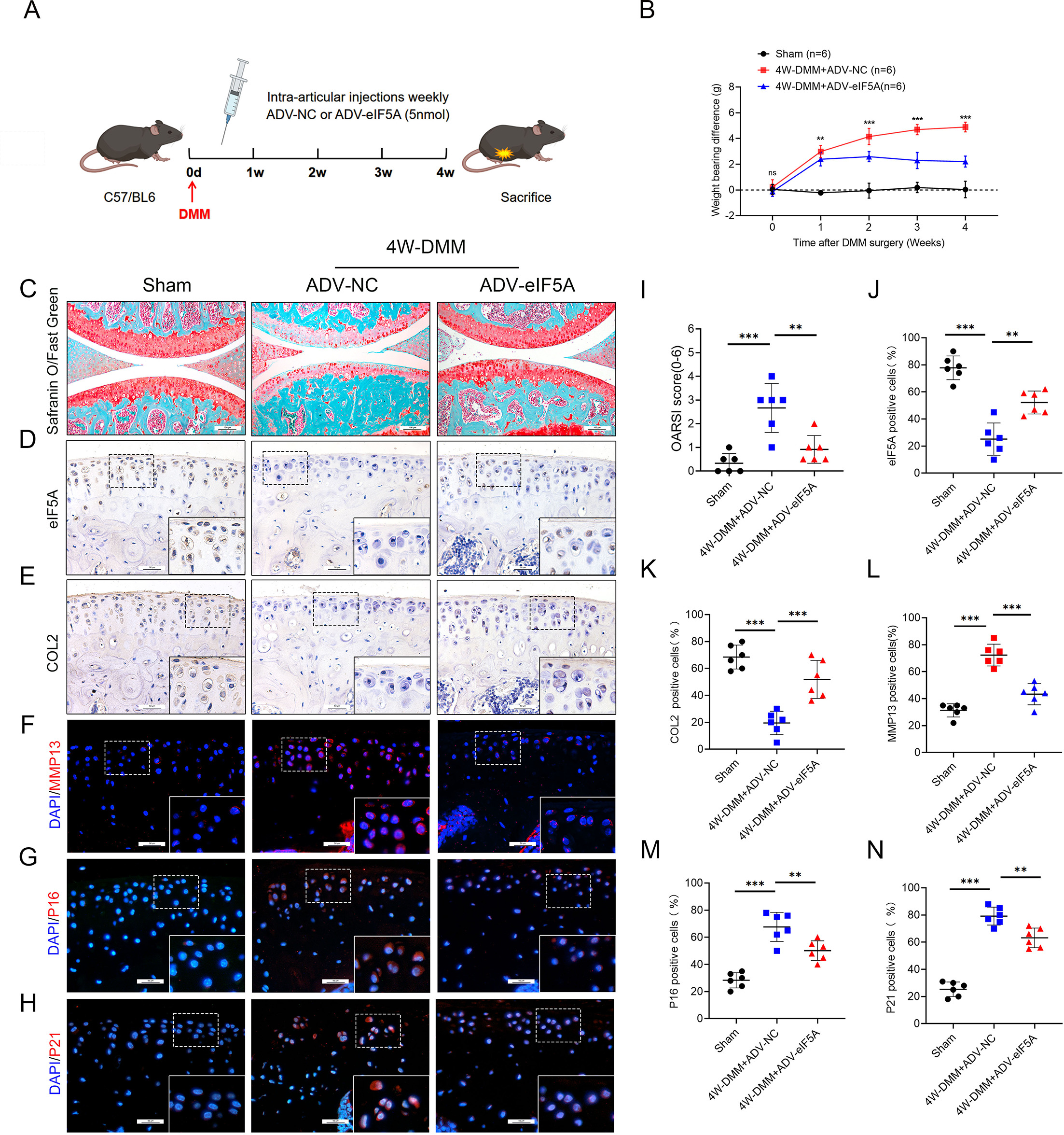 Fig. 3 
            Eukaryotic translation initiation factor 5A (eIF5A) can inhibit cartilage degeneration and delay osteoarthritis (OA) progression in destabilization of the medial meniscus (DMM)-OA mice. a) Protocol for intra-articular injection of ADV-NC or ADV-eIF5A in medial meniscus instability (DMM) mice. b) Analysis of weekly weightbearing asymmetry in mice. c) Safranin O/Fast Green staining of knee cartilage from control, DMM, and post-DMM eIF5A adenovirus-injected mice. Scale bar: 100 µm. d) and e) Immunohistochemistry (IHC) staining of eIF5A and type II collagen (COL2) in knee cartilage of control, DMM, and post-DMM eIF5A adenovirus-injected mice. Scale bar: 50 µm. f) to h) Immunofluorescence (IF) staining of matrix metalloproteinase (MMP13), P16, and P21 in knee cartilage of control, DMM, and post-DMM eIF5A adenovirus-injected mice. Scale bar: 50 µm. i) to n) Quantitative analysis of the Osteoarthritis Research Society International (OARSI) scoring scale in mice in Fig. 3a and the number of positive particles in Fig. 3d to 3h of articular cartilage; n = 6 per group. One-way analysis of variance was used for statistical analyses (*p < 0.05, **p < 0.01, ***p < 0.001). 4W, four weeks; ADV, adenovirus; NC, negative control; ns, not significant.
          