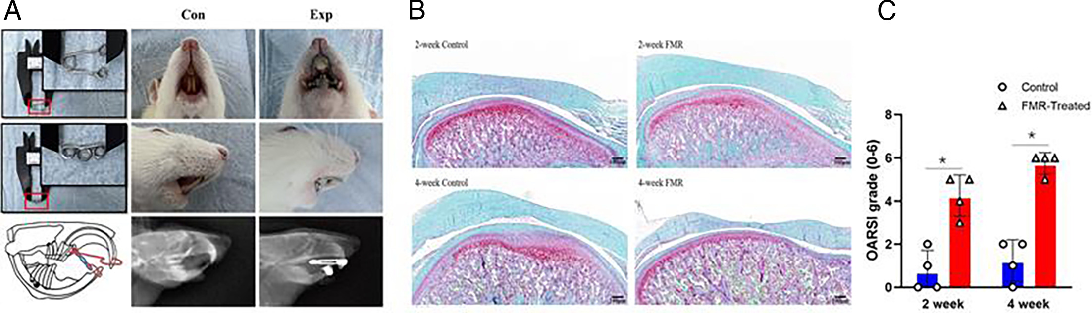 Fig. 1 
            Forced mandibular retrusion (FMR) resulted in temporomandibular joint (TMJ) degeneration. a) Upper and lower jaw gears made of stainless steel; diagram of FMR animal model; frontal view of animal in control group; lateral view of animal in control group; jaw radiograph of animal in control group; frontal view of animal in FMR group; lateral view of animal in FMR group; and jaw radiograph of animal in FMR group. b) Safranin O/Fast Green staining of mandibular condyles in control and experimental groups at two and four weeks. Scale bar: 100 μm. c) Graph showing the Osteoarthritis Research Society International (OARSI) score in two- and four-week FMR groups (n = 2 rat/group). *p < 0.05, **p < 0.01, independent-samples t-test.
          