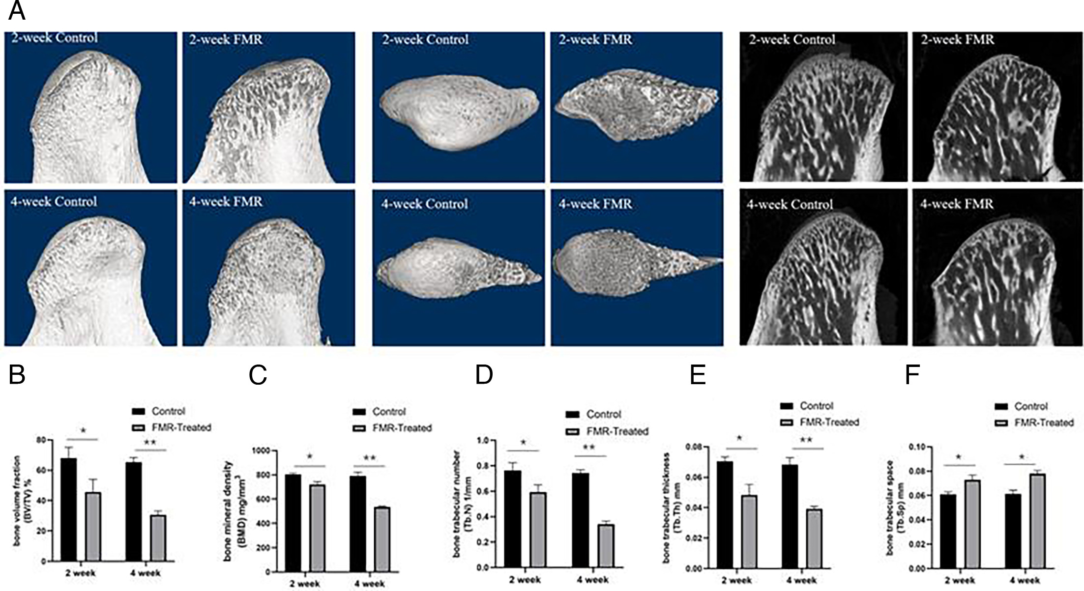 Fig. 2 
            a) Representative 3D and 2D micro-CT samples from two- and four-week control and experimental groups. b) Bone volume fraction (BV/TV) analysis. c) Bone mineral density (BMD) analysis. d) Bone trabecular number (Tb.N) analysis. e) Bone trabecular thickness (Tb.Th) analysis. f) Bone trabecular space (Tb.Sp) analysis. These micro-CT parameters were analyzed using one-way analysis of variance to compare data among control group and experimental groups (2 wks and 4 wks), n = 4 rat/group. *p < 0.05, **p < 0.01, t-test. FMR, forced mandibular retrusion.
          