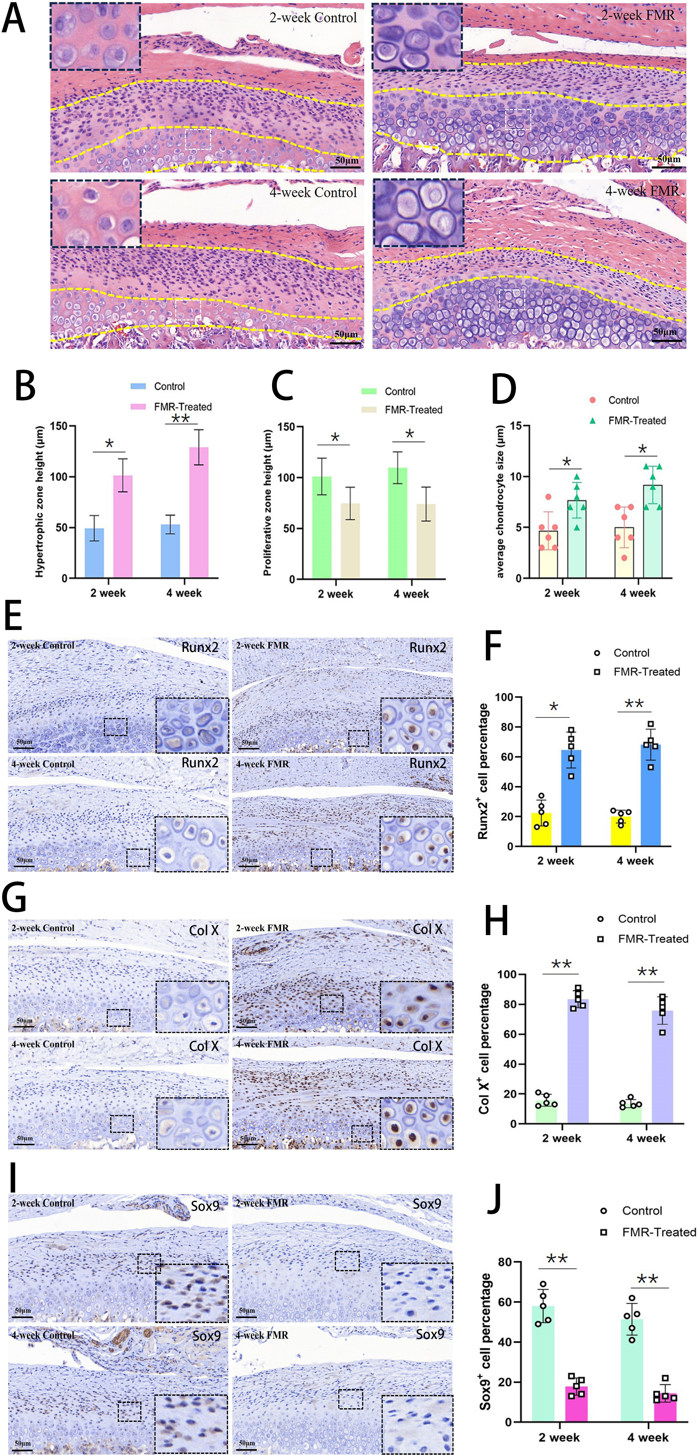 Fig. 3 
            Excessive chondrocyte hypertrophy occurred in forced mandibular retrusion (FMR)-induced temporomandibular joint (TMJ) degeneration. a) Haematoxylin and eosin (H&E) staining of mandibular condyles in control and experimental groups at two and four weeks. Yellow dashed lines mark the upper proliferative zone and lower hypertrophic zone in cartilage; n = 2 rat/group. Scale bar: 50 μm. b) Graph showing the hypertrophic zone height in control and experimental groups at two and four weeks. c) Graph showing the proliferative zone height in control and experimental groups at two and four weeks. d) Graph showing the average chondrocyte size in control and experimental groups at two and four weeks. e) Representative Runx2 immunohistochemistry staining of condyles in control and experimental groups at two and four weeks. f) Graph showing the Runx2 positive cell percentage according to immunohistochemistry staining of condyles in control and experimental groups at two and four weeks. g) Representative Col X immunohistochemistry staining of condyles in control and experimental groups at two and four weeks. h) Graph showing the Col X positive cell percentage according to immunohistochemistry staining of condyles in control and experimental groups at two and four weeks. i) Representative Sox9 immunohistochemistry staining of condyles in control and experimental groups at two and four weeks. j) Graph showing the Sox9 positive cell percentage according to immunohistochemistry staining of condyles in control and experimental groups at two and four weeks. n = 3 rat/group. *p < 0.05, **p < 0.01, t-test. Scale bar: 50 μm.
          