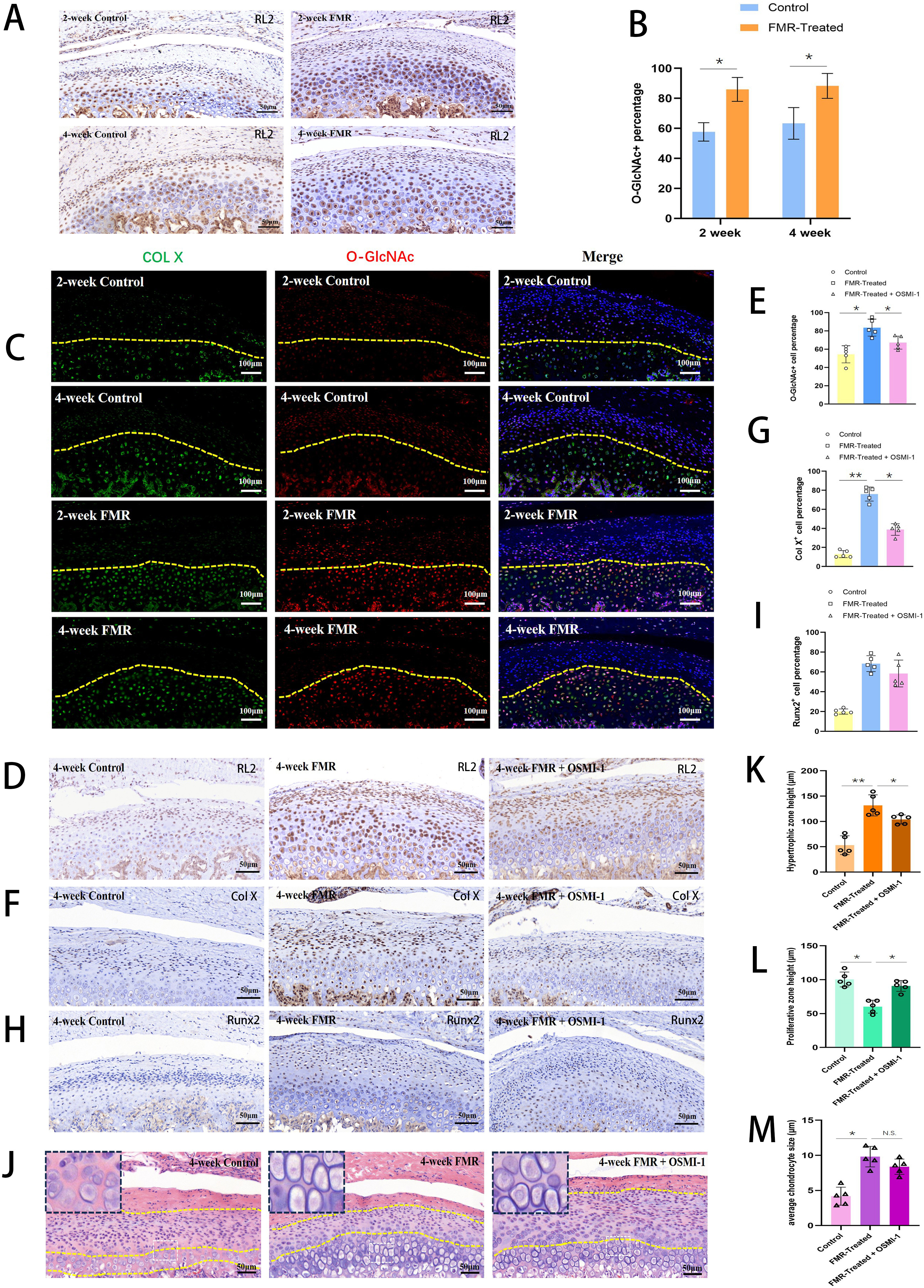 Fig. 4 
            Intracellular O-GlcNAcylation was involved in regulating chondrocyte hypertrophy in forced mandibular retrusion (FMR)-induced temporomandibular joint (TMJ) degeneration. a) Representative RL2 immunohistochemistry staining of condyles in control and experimental groups at two and four weeks. Scale bar: 50 μm. b) Graph showing the O-GlcNAc positive cell percentage according to immunohistochemistry staining of condyles in control and experimental groups at two and four weeks. c) Representative RL2 and Col X double immunofluorescence staining of condyles in control and experimental groups at two and four weeks. Scale bar: 100 μm. d) Representative RL2 immunohistochemistry staining of condyles in four-week control, four-week FMR, and four-week FMR administered with OSMI-1 groups. e) Graph showing the O-GlcNAc positive cell percentage according to immunohistochemistry staining of condyles in four-week control, four-week FMR, and four-week FMR administered with OSMI-1 groups. f) Representative Col X immunohistochemistry staining of condyles in four-week control, four-week FMR, and four-week FMR administered with OSMI-1 groups. g) Graph showing the Col X positive cell percentage according to immunohistochemistry staining of condyles in four-week control, four-week FMR, and four-week FMR administered with OSMI-1 groups. h) Representative Runx2 immunohistochemistry staining of condyles in four-week control, four-week FMR, and four-week FMR administered with OSMI-1 groups. i) Graph showing the Runx2 positive cell percentage according to immunohistochemistry staining of condyles in four-week control, four-week FMR, and four-week FMR administered with OSMI-1 groups. Scale bar: 50 μm. N = 3 rat/group. *p < 0.05, **p < 0.01. j) H&E staining of mandibular condyles in four-week control, four-week FMR, and four-week FMR administered with OSMI-1 groups. Yellow dashed lines mark the upper proliferative zone and lower hypertrophic zone in cartilage. N = 2 rat/group. Scale bar: 50 μm. k) Graph showing the hypertrophic zone height in four-week control, four-week FMR, and four-week FMR administered with OSMI-1 groups. l) Graph showing the proliferative zone height in four-week control, four-week FMR, and four-week FMR administered with OSMI-1 groups. m) Graph showing the average chondrocyte size in four-week control, four-week FMR, and four-week FMR administered with OSMI-1 groups. *p < 0.05, **p < 0.01, one-way analysis of variance. N. S., not significant.
          