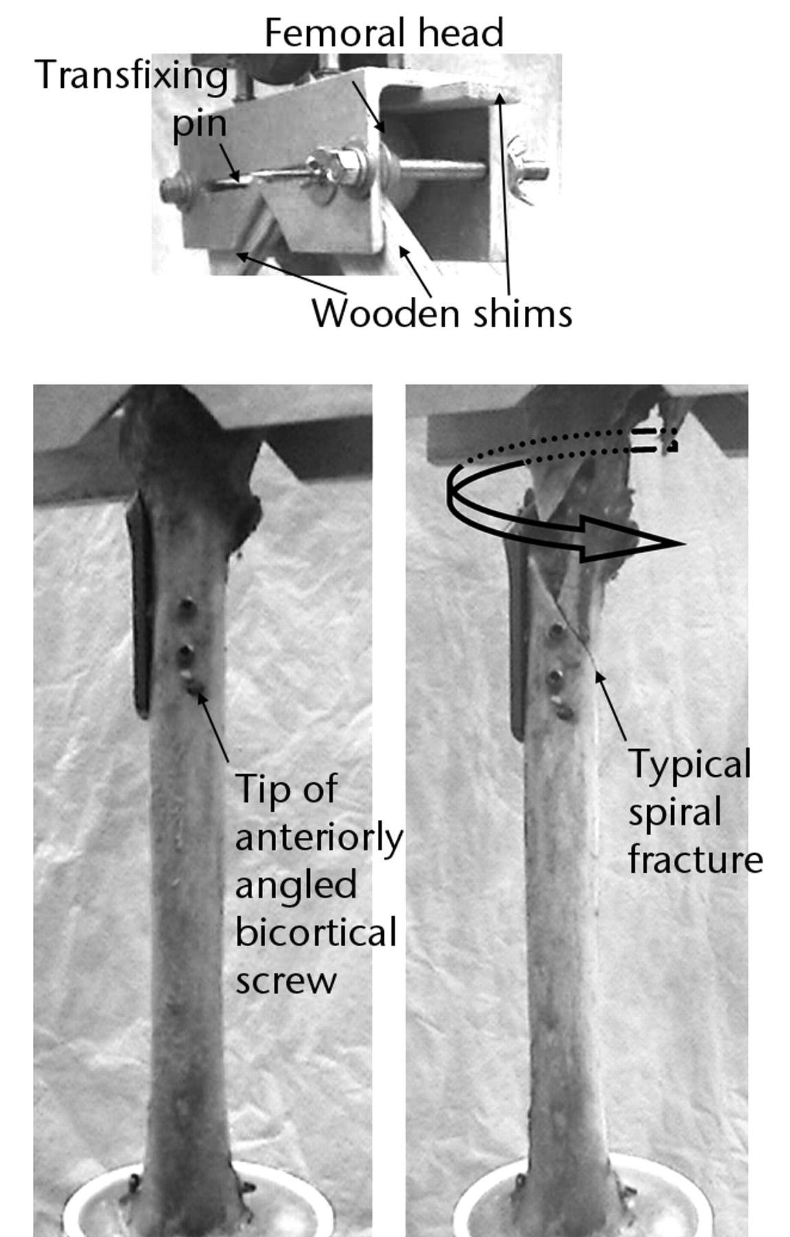Fig. 2 
            Photographs of the specimen setup in
the Instron testing machine, showing fixation of the specimen to
the jig (top), and anterior views of a cadaveric BLN specimen before
torsional loading to failure (left) and after failure with fragment
rotated back to starting position (right).
          