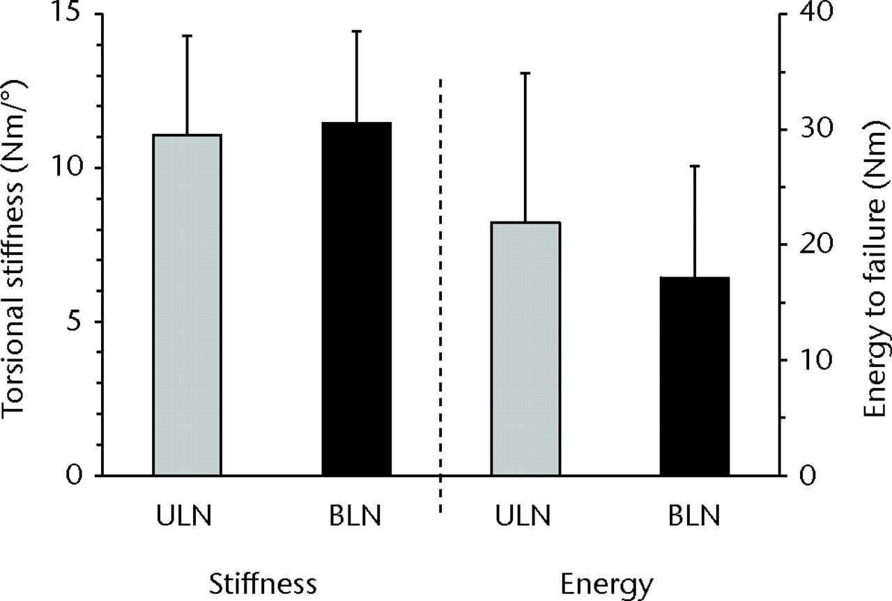 Fig. 5 
            Bar charts showing torsional stiffness
and energy to failure for the two cadaveric constructs of unicortical long
nail (ULN) and bicortical long nail (BLN). No statistically significant
differences were observed, despite a higher mean energy required
for failure in the ULN construct. The error bars depict the standard deviation.
          