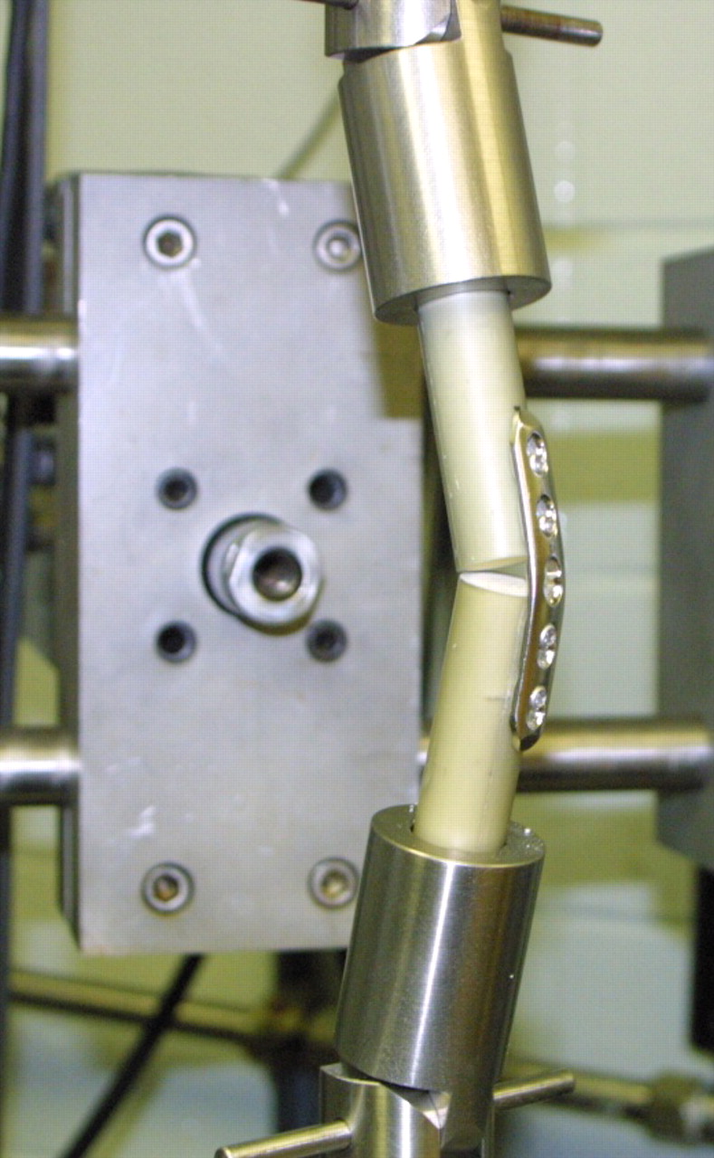 Fig. 2 
            Photograph showing eccentric bending
of the five-hole plate fixed with locking screws. Constructs were
tested cyclically until failure with the MTS Bionix frame.
          
