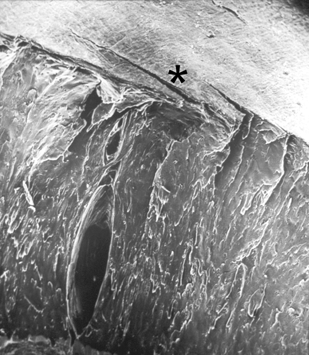 Fig. 2 
          Electron microscope image showing fissuring
in the radial zone below an intact surface layer. The slits marked
with * are the result of the freeze fracturing technique.
        
