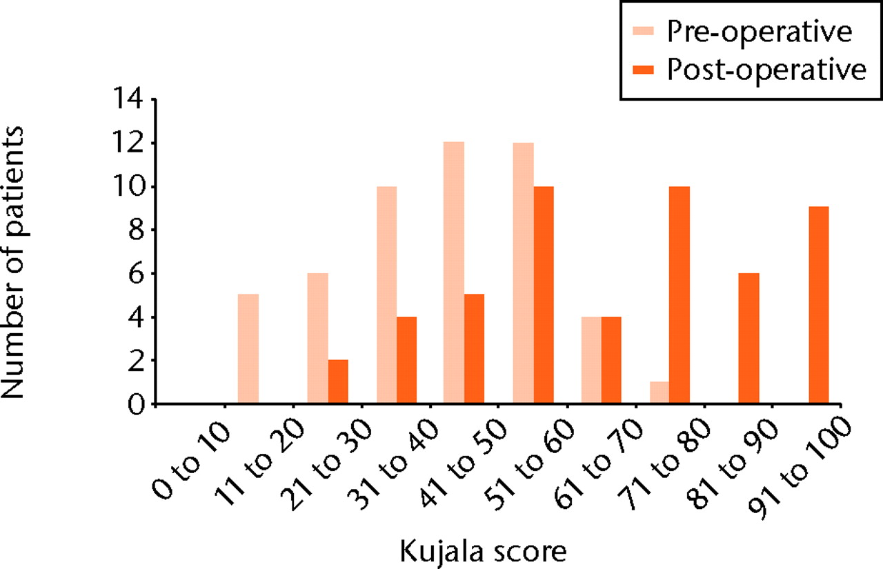 Fig. 5 
            Bar chart showing the distribution of
Kujala scores pre-operatively and at five years post-operatively.
          