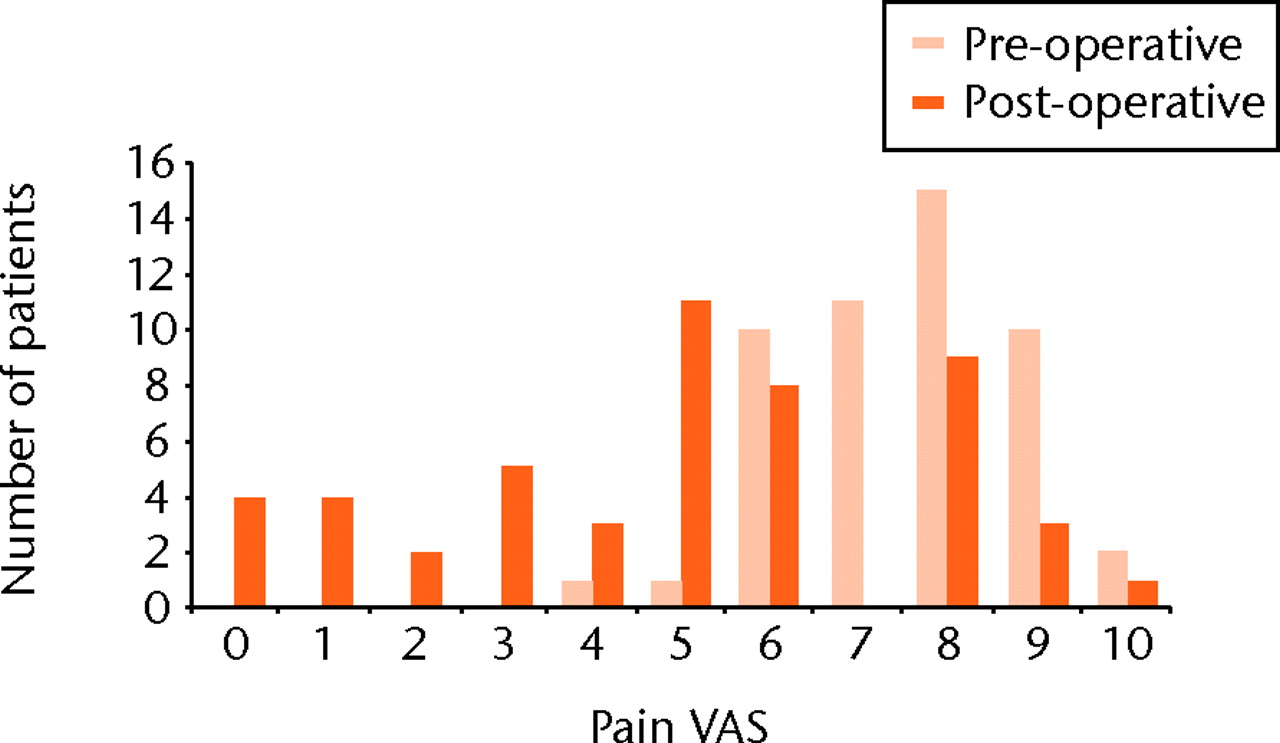 Fig. 6 
            Bar chart showing the distribution of
the visual analogue scale (VAS) for pain pre-operatively and at
five years post-operatively.
          