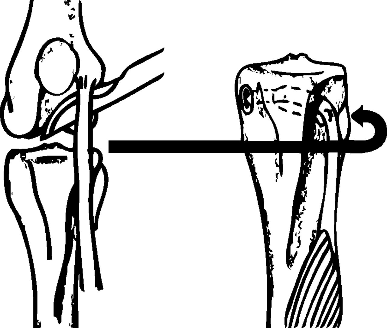 Fig. 1 
          Schematic drawing of the surgical
procedure used in the study.
        