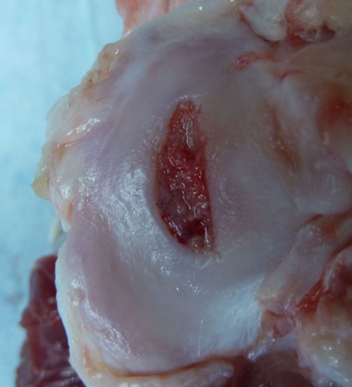 Figs. 3a - 3b 
            Photograph at macroscopic assessment
showing the Asnis screw (Stryker GmbH) fixation a) in the femoral
surface and b) the corresponding tibial surface, showing marked
and deep chondral damage.
          