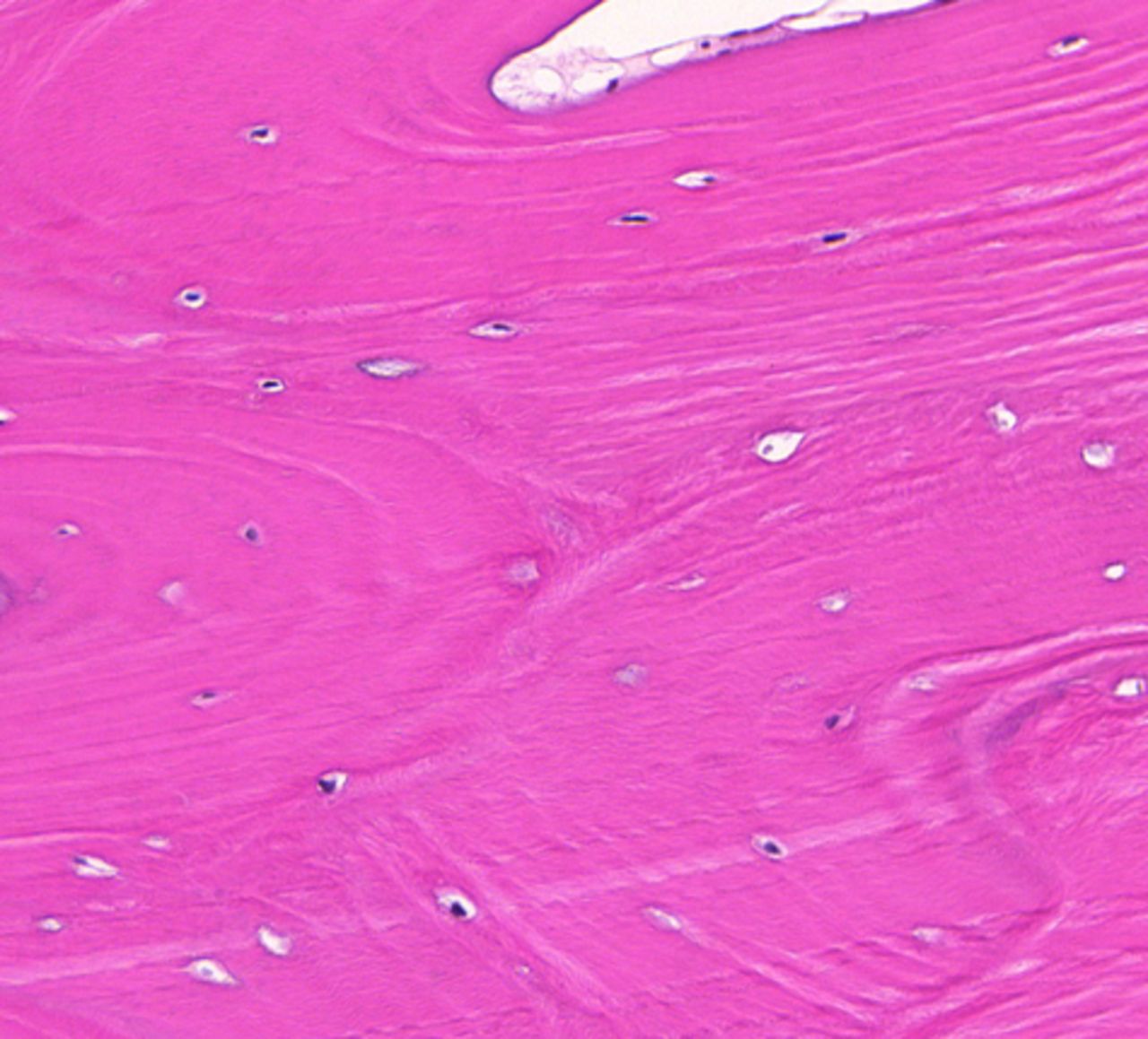 Figs. 4a - 4b 
            Slide from a) the non-posterior
group showing nucleated lacunae (magnification ×20) and b) the hip
with avascular necrosis, showing mostly empty lacuna (magnification
×40, both haematoxylin and eosin).
          