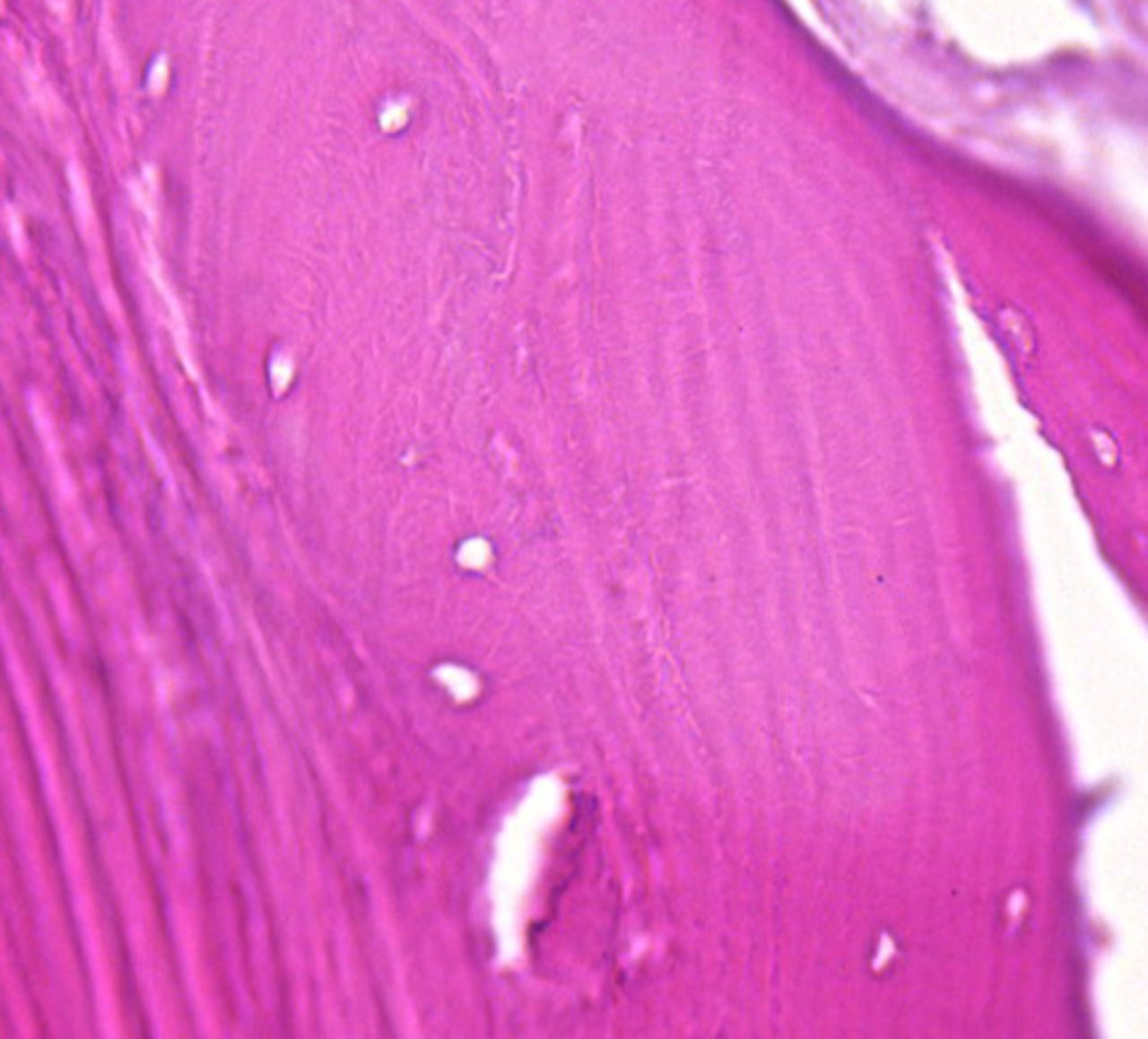 Figs. 4a - 4b 
            Slide from a) the non-posterior
group showing nucleated lacunae (magnification ×20) and b) the hip
with avascular necrosis, showing mostly empty lacuna (magnification
×40, both haematoxylin and eosin).
          