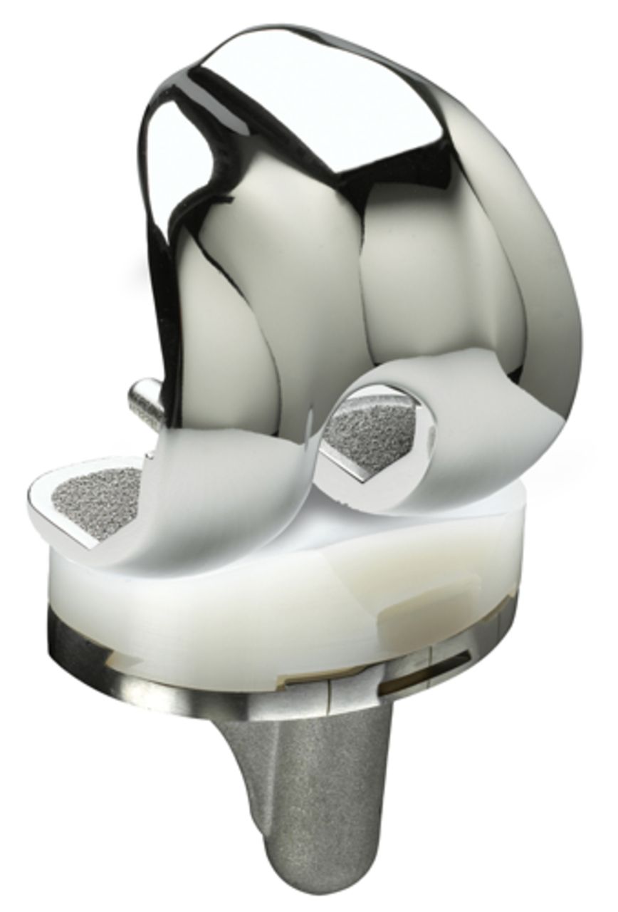 Fig. 1 
          Image of the ADVANCE Medial-Pivot System
(image courtesy of MicroPort Orthopedics Inc., Arlington, Tenessee).
        