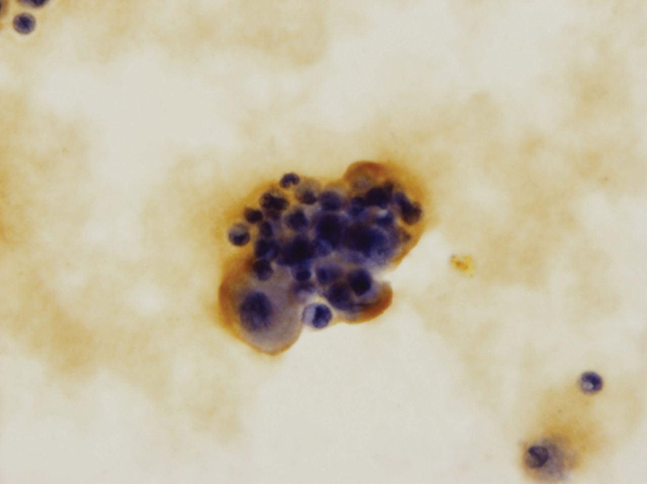 Fig. 1 
            Histological examination of the S-100
cultured chondrocytes (x 400). 
          