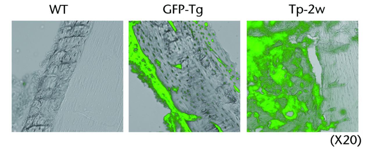 Figs. 2a - 2b 
          
            Figure 2a – Histological analyses
of the femur from a rat bone defect model. Left panel indicates
the wild-type rat as a negative control (n = 4), middle panel indicates
the GFP-Tg rat as a positive control (n = 1), and right panel indicates
the bone defect rat transplanted with osteoblast-like cells after
two weeks of transplantation (Tp-2w, n = 4). Images (x 20) are merged
with GFP field and bright field. Figure 2b – Low magnification images
of the femur from bone defect rats transplanted with osteoblast-like
cells (x2). Histological analysis of the bone defect rats was performed
after two weeks of transplantation (Tp-2w). The scaffolds contain
osteoblast-like cells were located on the defected site. The images
on the right are merged with GFP field and bright field (BF).
        