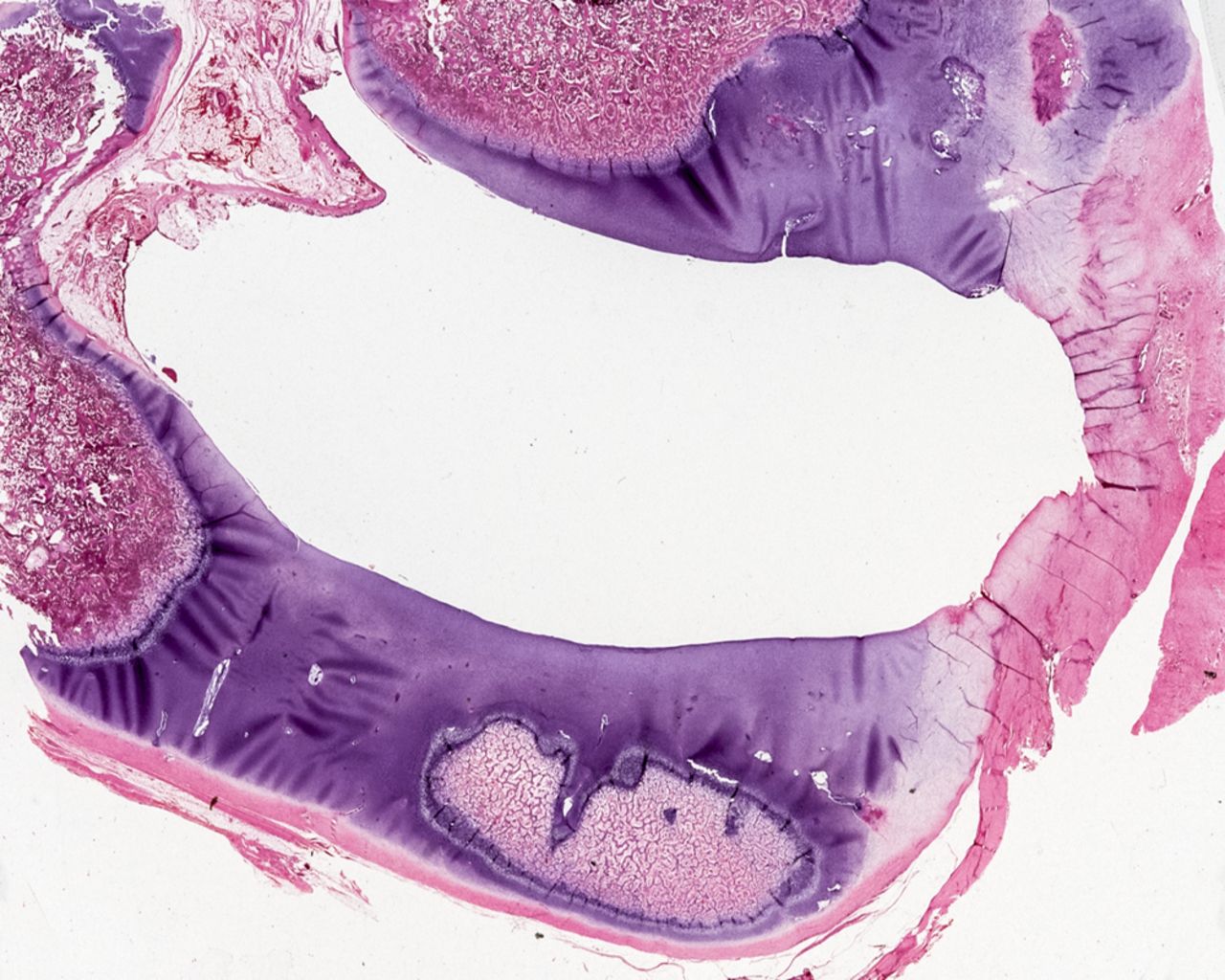 Fig. 6 
          Photomicrograph of histologic cross-section
of the acetabulum from the operated side eight weeks post-surgery
shows markedly abnormal articular cartilage surface shape, under-developed
and asymmetric bones and relatively more extensive persisting cartilage
(hematoxylin and eosin stain).
        
