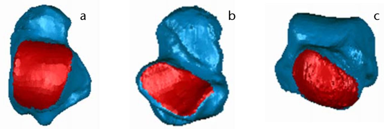 Fig. 1 
          Images of talus bone morphology
(from left) a) Dorsal view; b) Plantar view; c) Anterior view. Articular
surfaces (i.e., talar dome (a), subtalar (b), and talar head (c)
are shown in red.
        