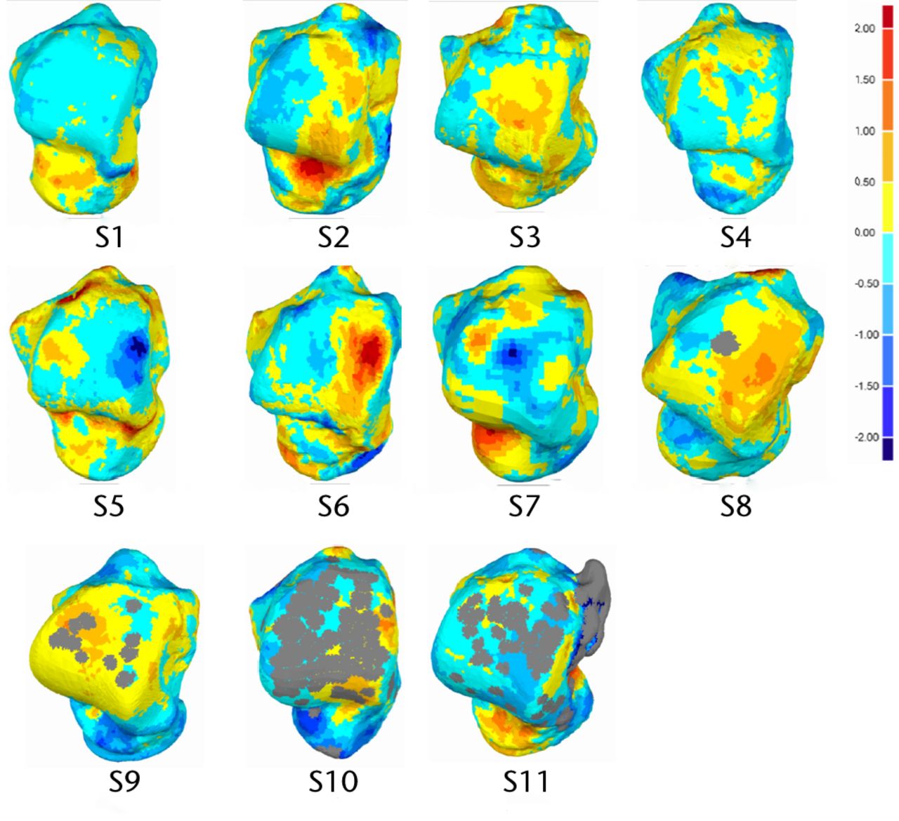 Fig. 2 
          Dorsal view of analysed talus models
and deviation colour maps (mm).
        