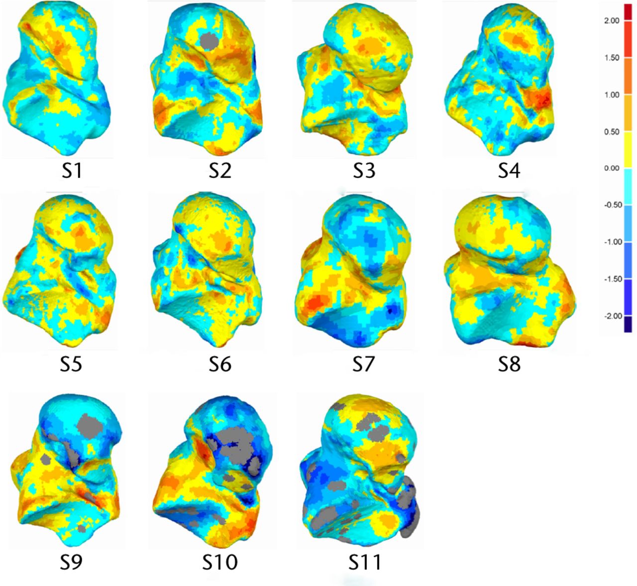 Fig. 3 
          Plantar view of analysed talus models
and deviation colour maps (DCM) (mm).
        