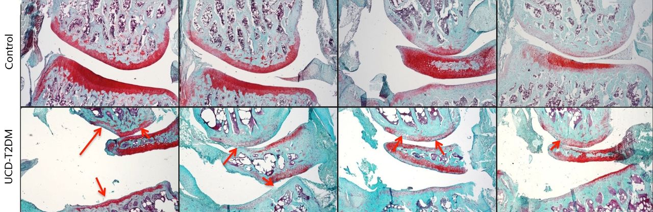Fig. 2 
            Micrographs showing the lateral aspect;
representative sections stained with Safranin-O/Fast Green, taken
at 5x magnification. Arrows indicate areas in which erosion of articular
cartilage, loss of staining, and other irregularities have occurred
in the UCD-T2DM group. On the lateral aspect of the knee in the
UCD-T2DM group, there is prominent reduction in articular cartilage
quality at the femoral condyle and thinning of the cartilage at
the tibial plateau.
          