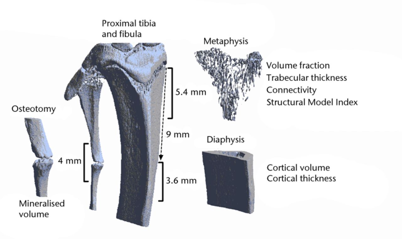 Fig. 1 
            Three-dimensional reconstruction
of a microCT scan of the proximal tibia and the proximal fibula.
The analysed regions of interest are indicated.
          