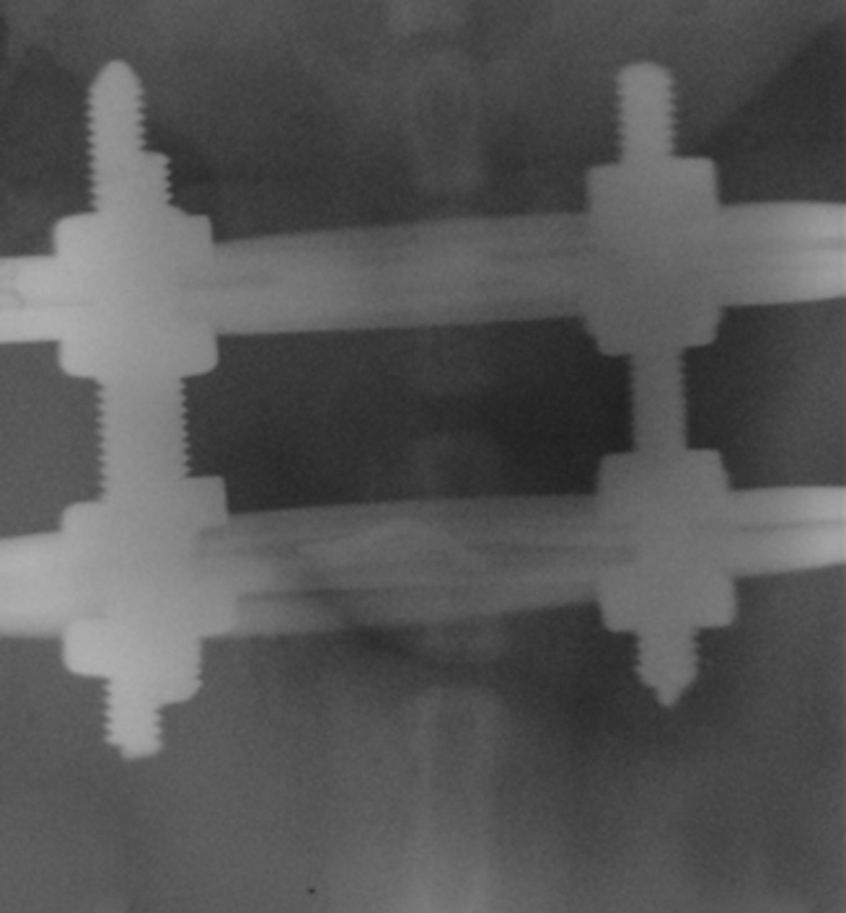 Expression Of Macrophage Elastase MMP12 In Rat Tail Intervertebral   2000326 Galleyfig1a 