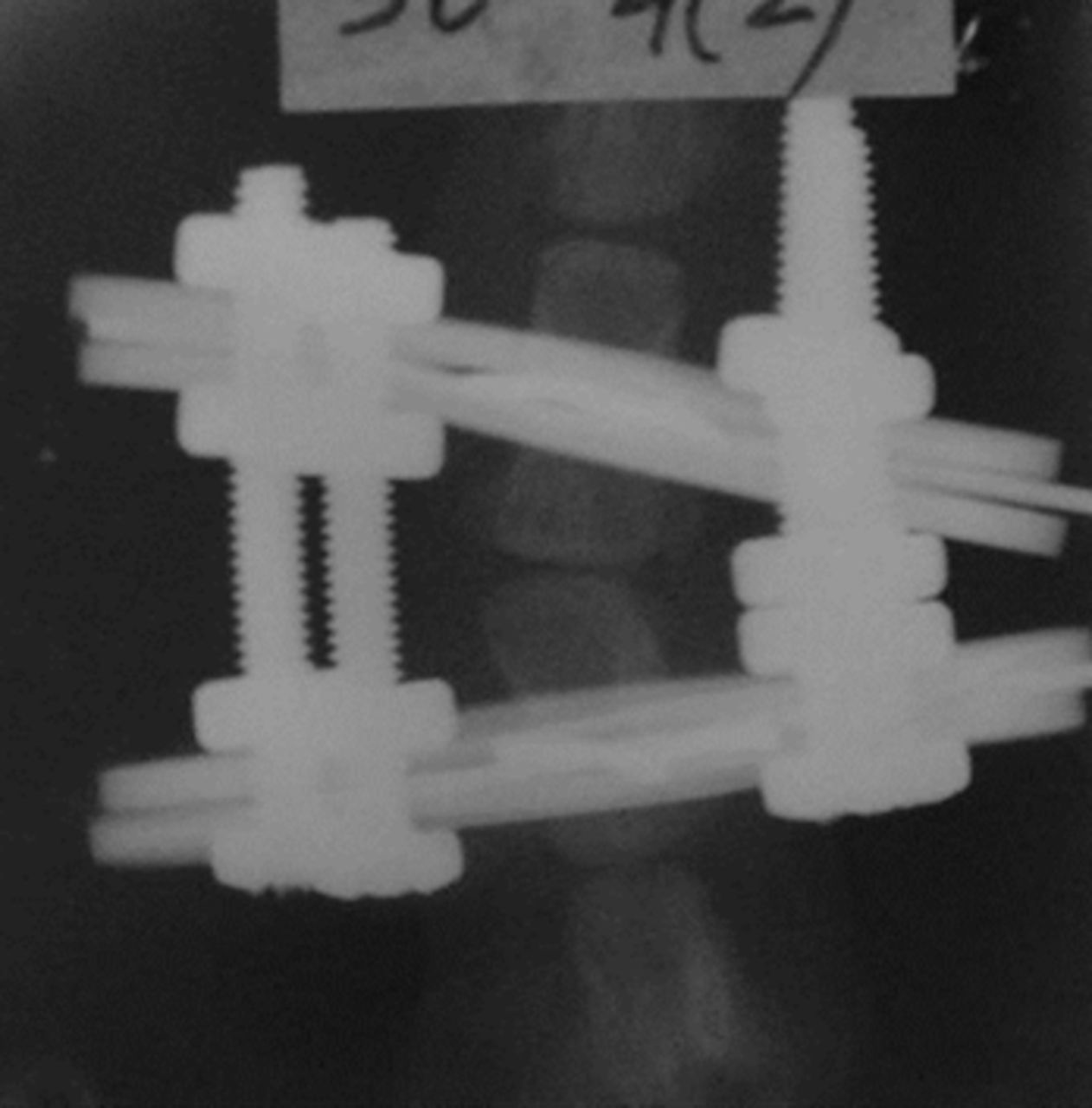 Expression Of Macrophage Elastase MMP12 In Rat Tail Intervertebral   2000326 Galleyfig1c 